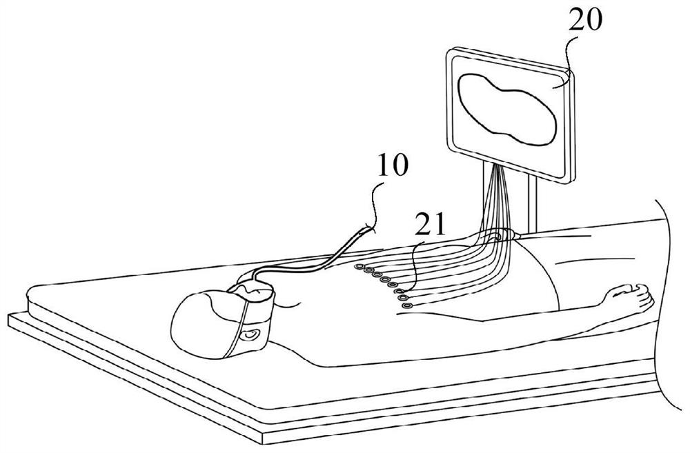 Detection method and system for determining pulmonary overexpansion by using electrical impedance tomography