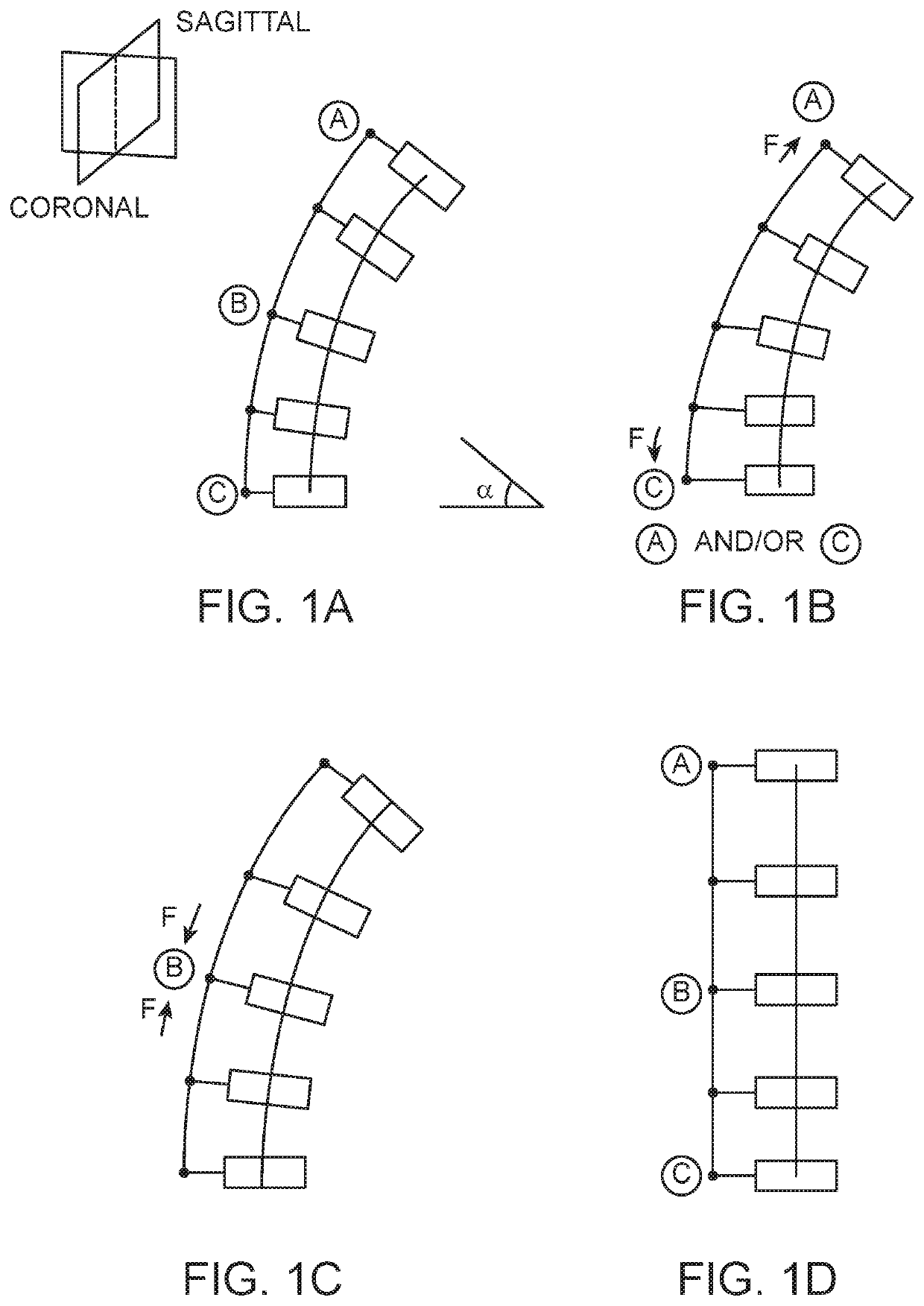 Spinal curvature modulation systems and methods