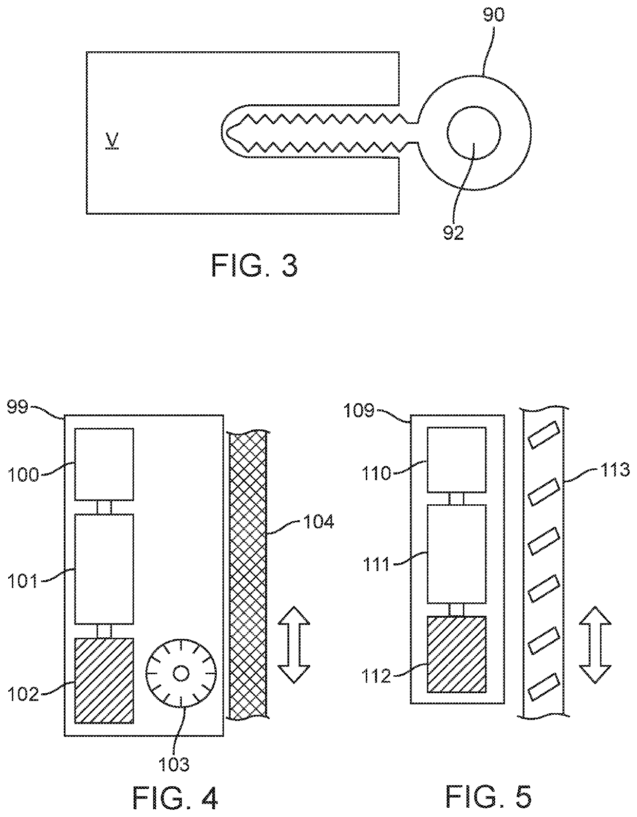 Spinal curvature modulation systems and methods