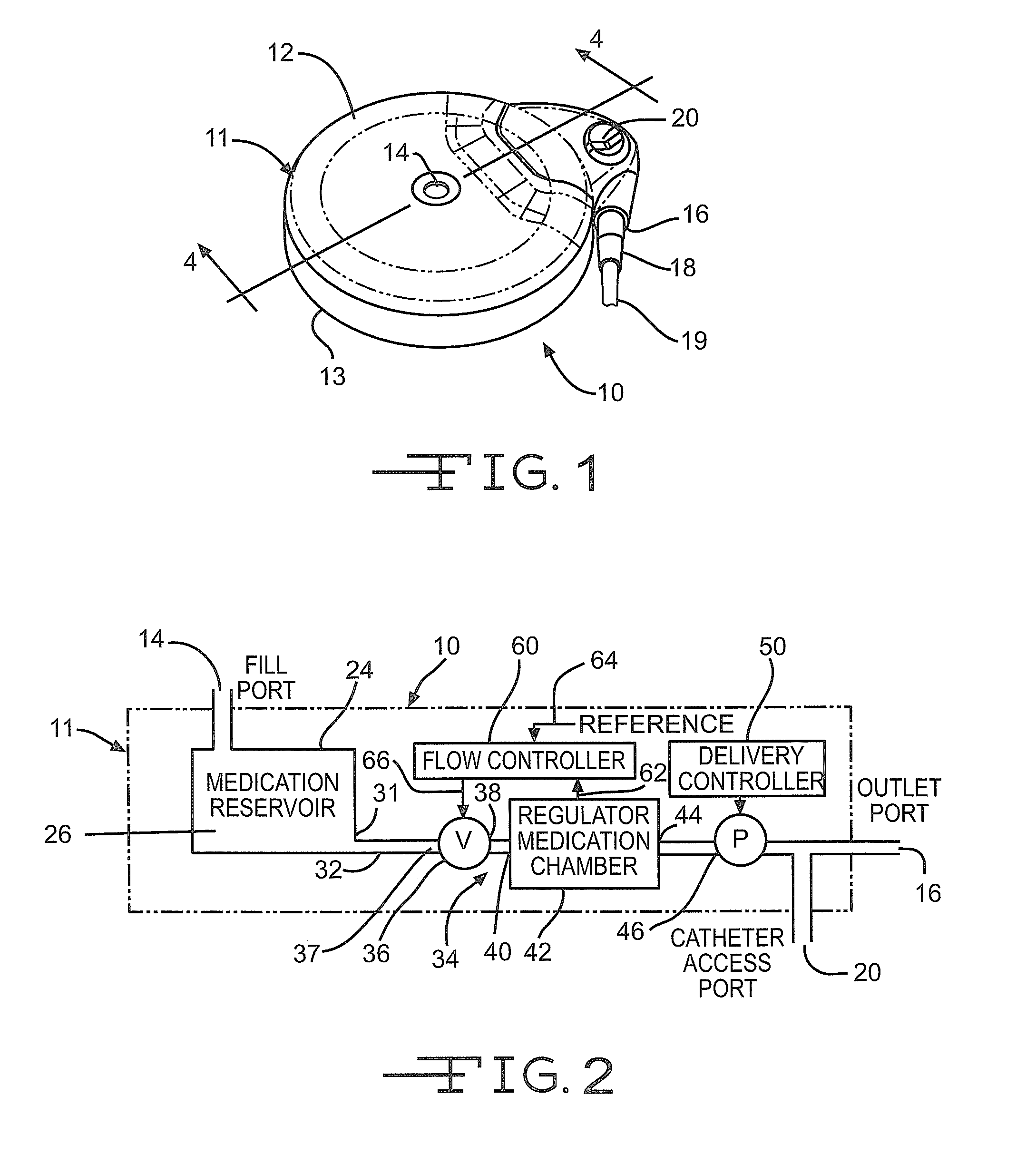 Implantable medication delivery device using pressure regulator