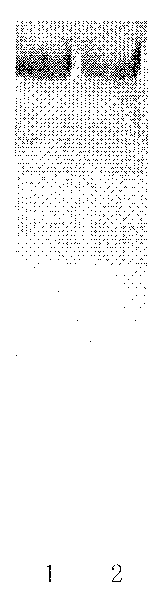 Preparation method of yolk antibody IgY of high-abundance protein in anti-human serum/blood plasma and application thereof