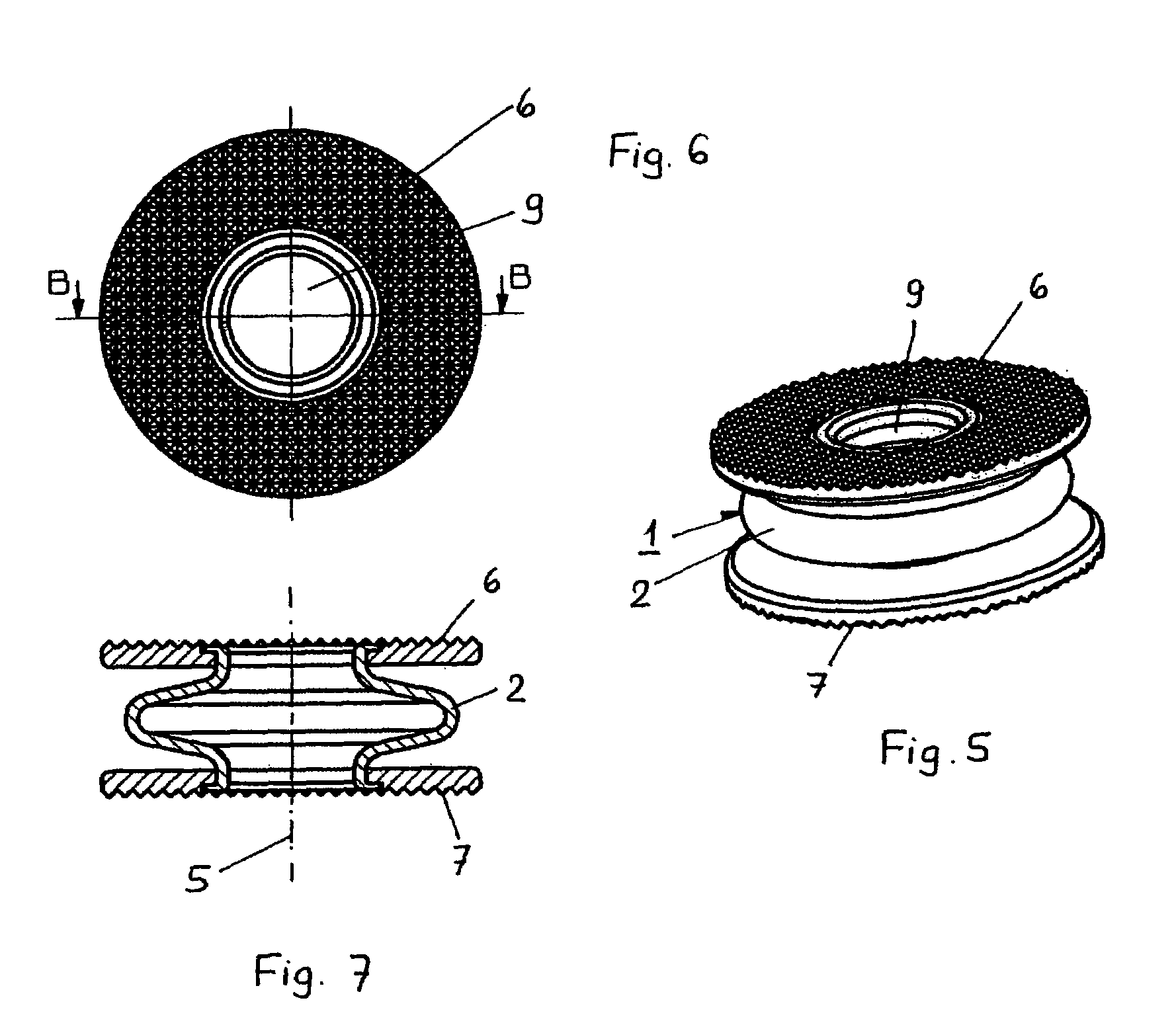 Intervertebral disk prosthesis or artificial vertebra