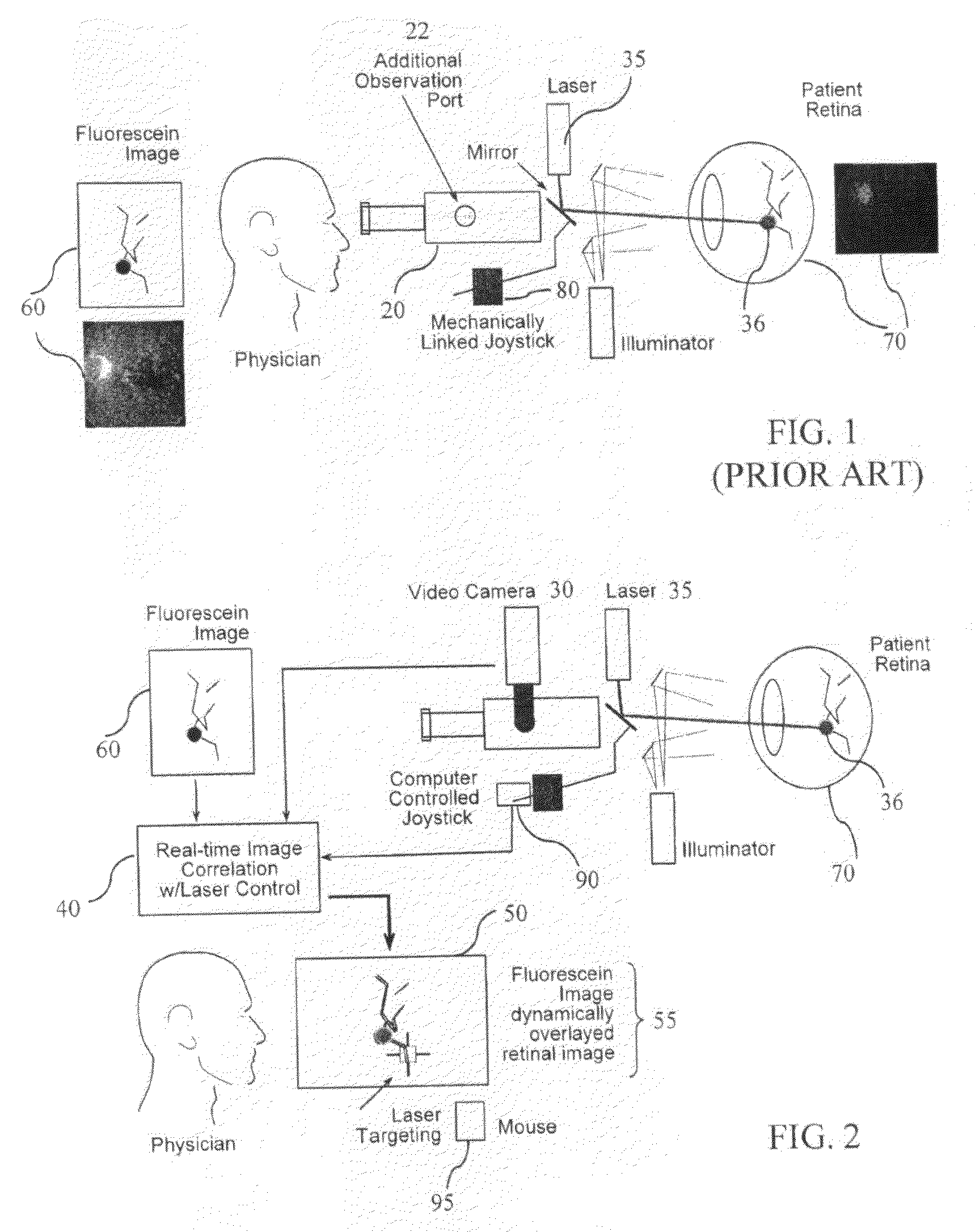 Devices and Methods for Computer-Assisted Surgery