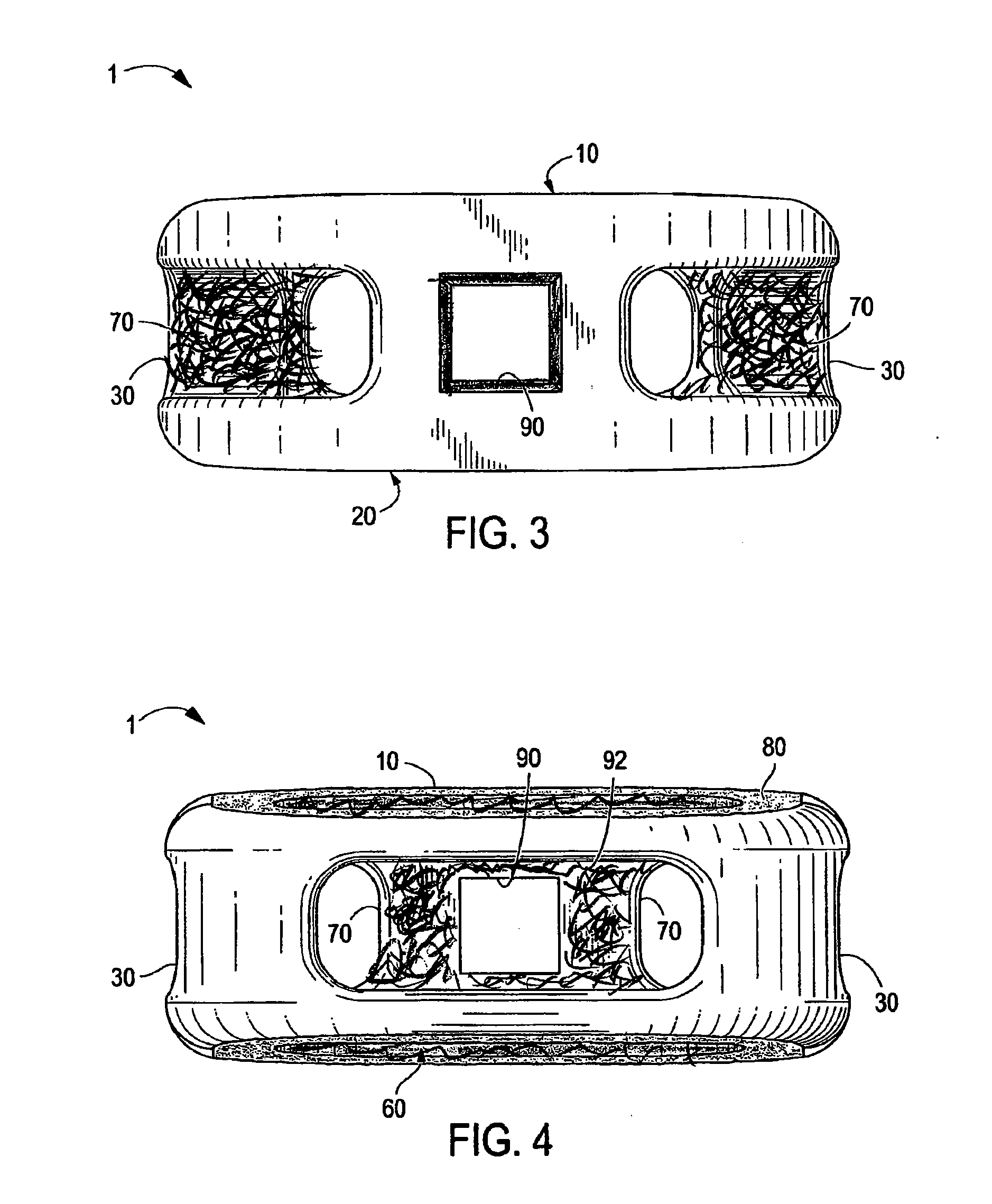 Interbody Spinal Implant Having Internally Textured Surfaces