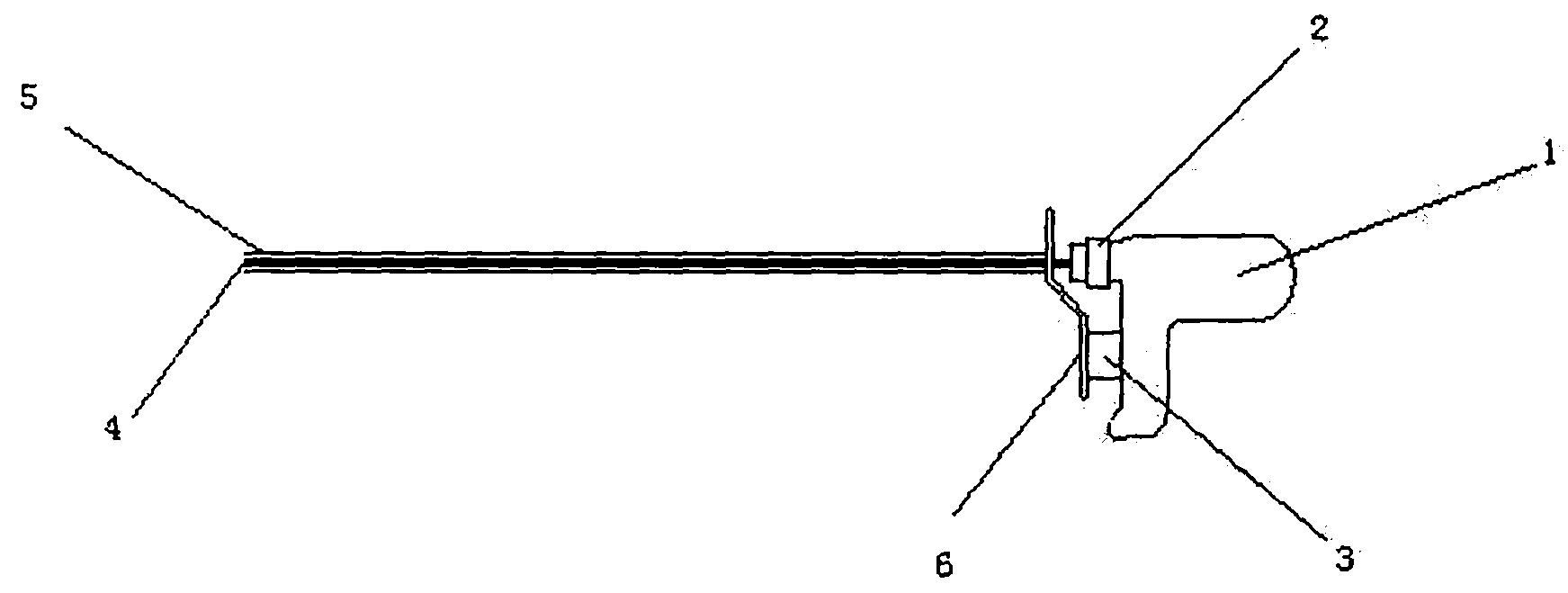 Intracavitary lithotripter for treating upper urinary tract calculi