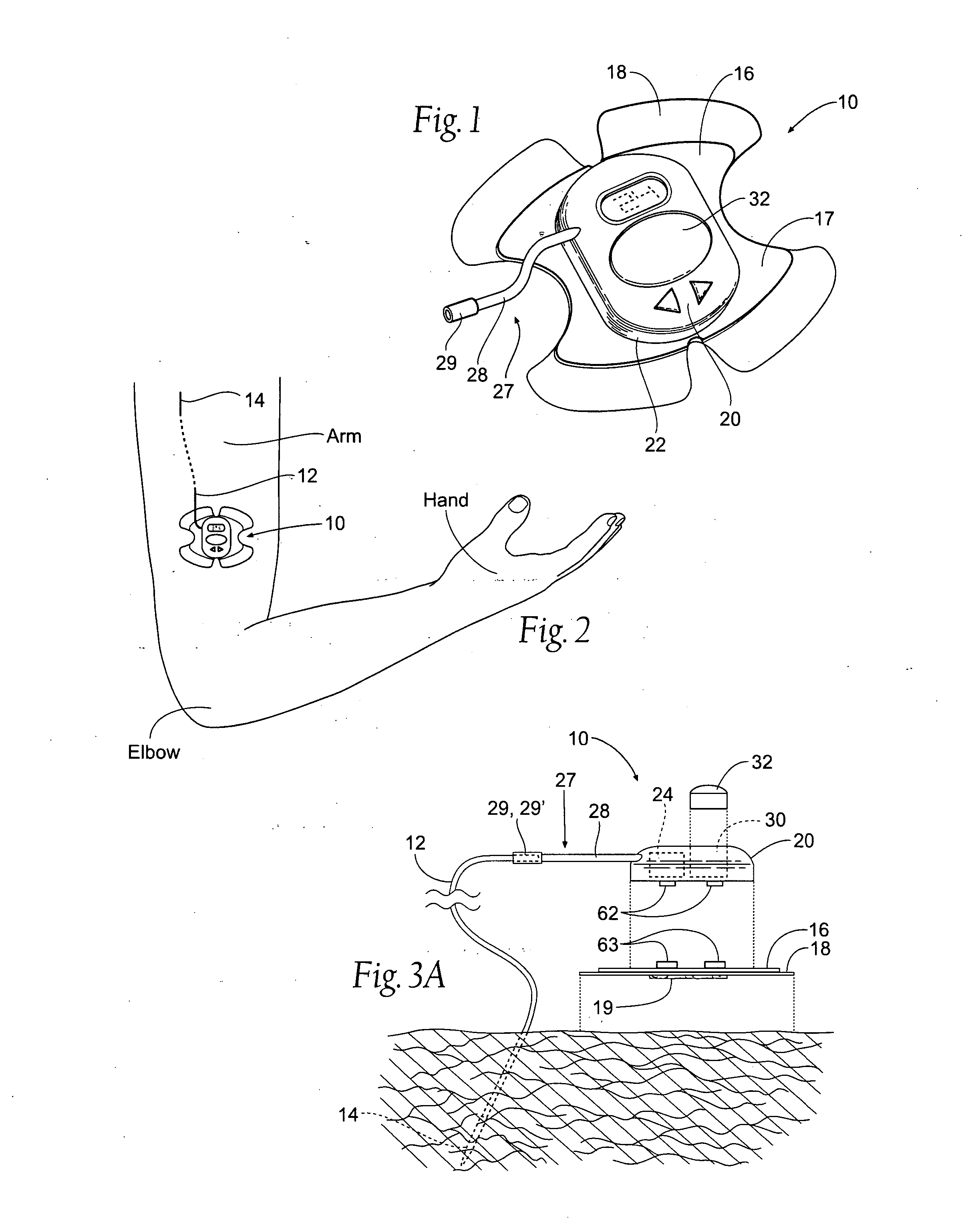 Portable assemblies, systems, and methods for providing functional or therapeutic neurostimulation