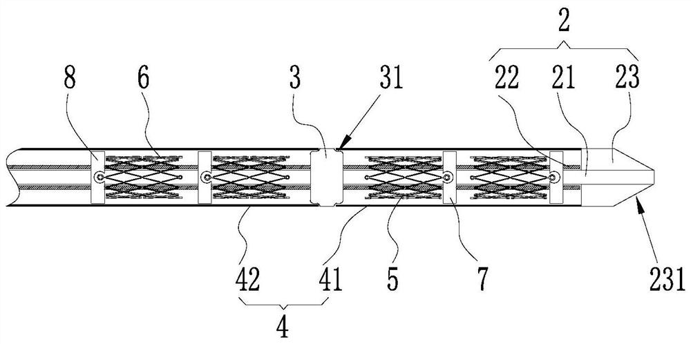 Self-expanding stent system