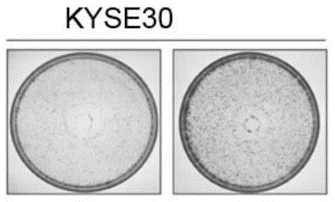 Use of microRNA-548k inhibitor in treatment and/or prevention of esophageal squamous cancer