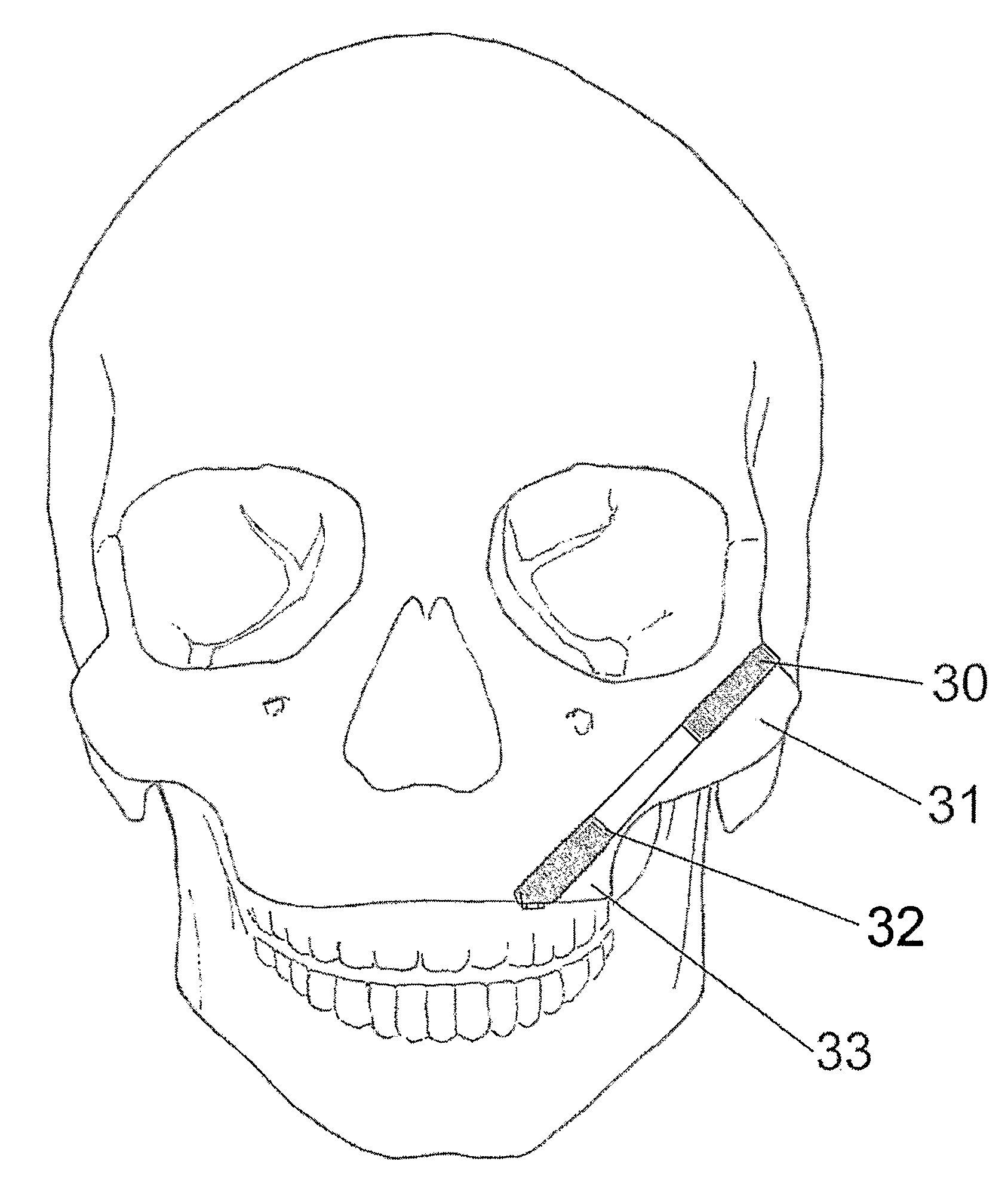 Anchoring Element, Dental Anchoring Member, and Dental Anchorning Unit