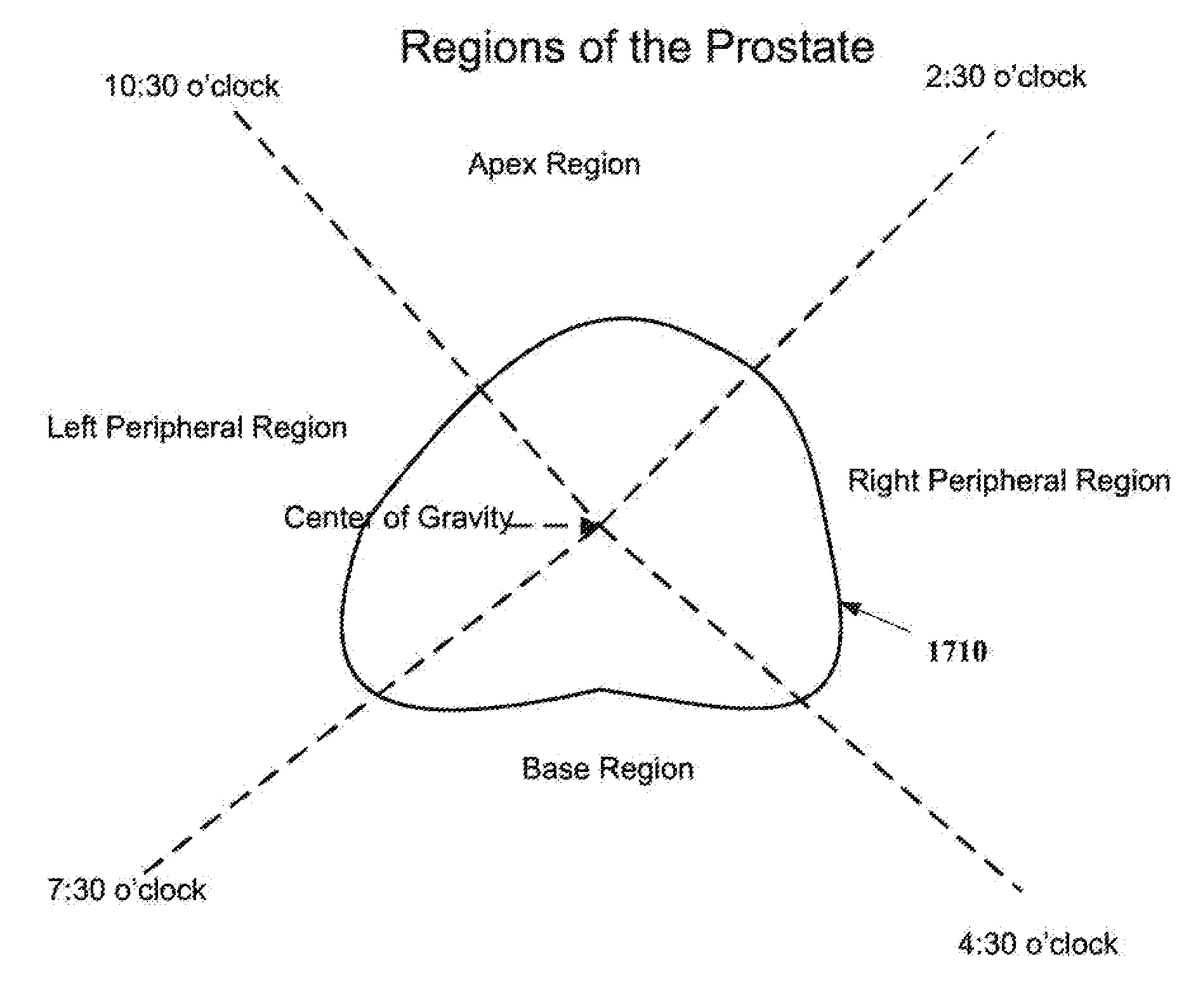 Object recognition system for medical imaging