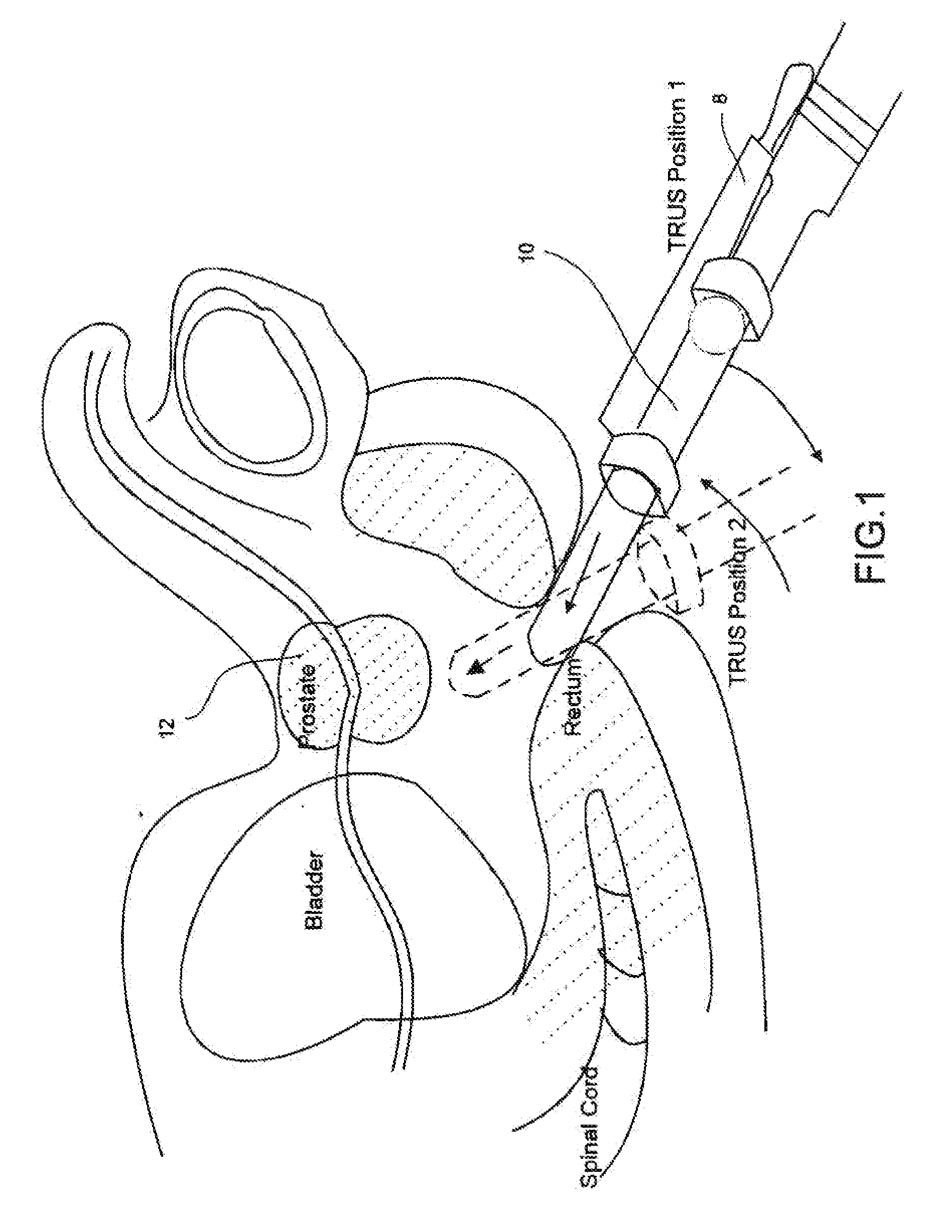 Object recognition system for medical imaging