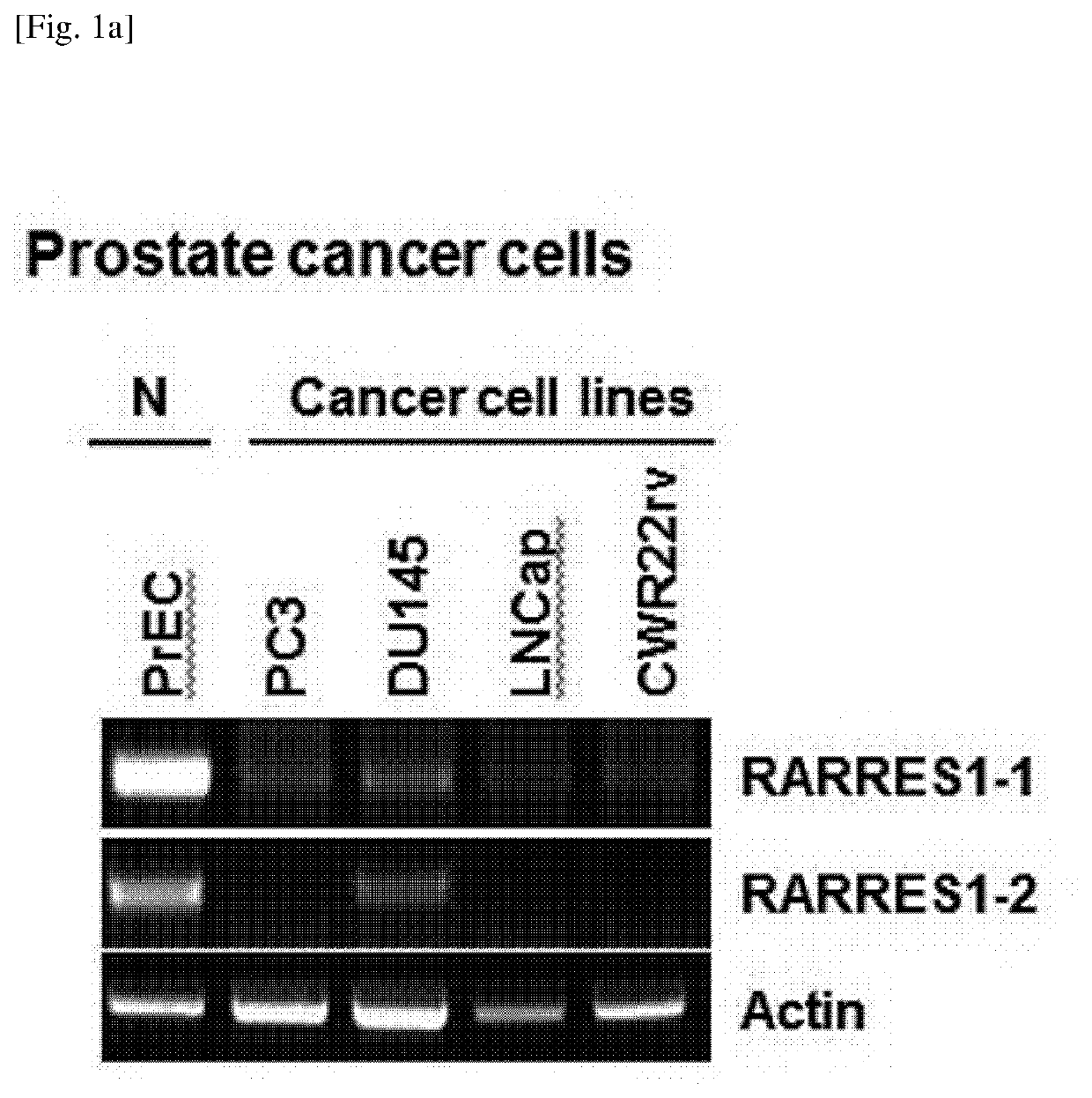 A method for screening a therapeutic agent for cancer using binding inhibitor of cyclin-dependent kinase 1 (CDK1)-cyclin b1 and retinoic acid receptor responder 1 (rarres1) gene knockout animal model