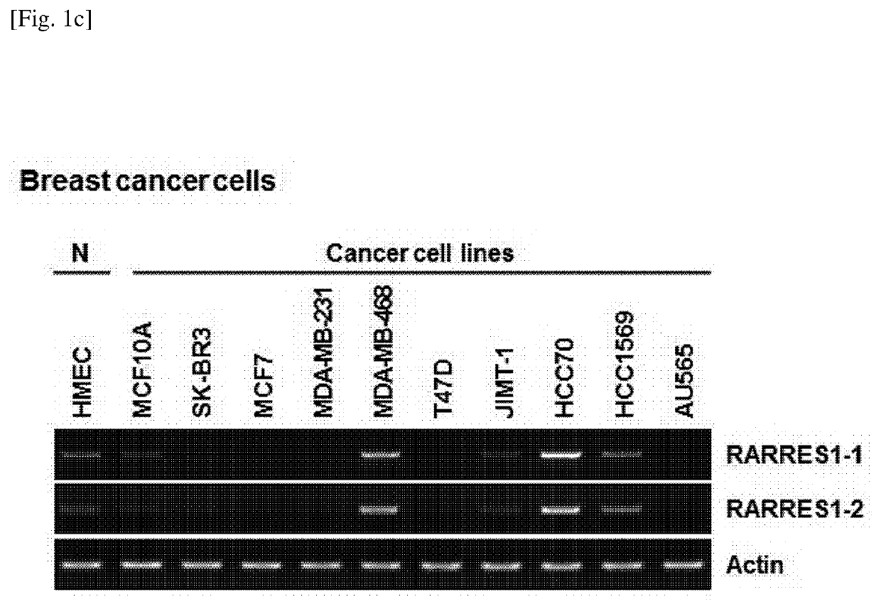 A method for screening a therapeutic agent for cancer using binding inhibitor of cyclin-dependent kinase 1 (CDK1)-cyclin b1 and retinoic acid receptor responder 1 (rarres1) gene knockout animal model