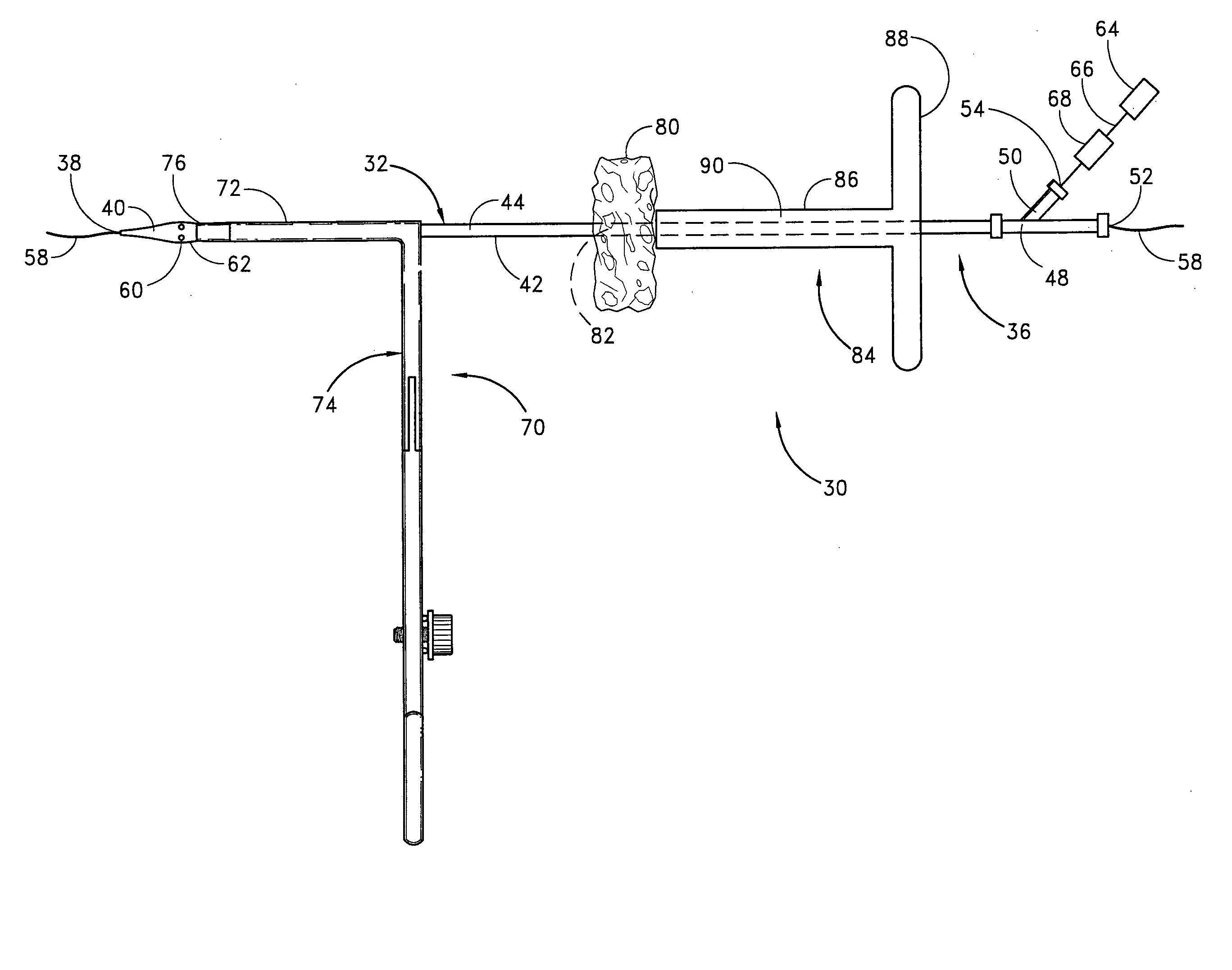 Apparatus for closing vascular puncture