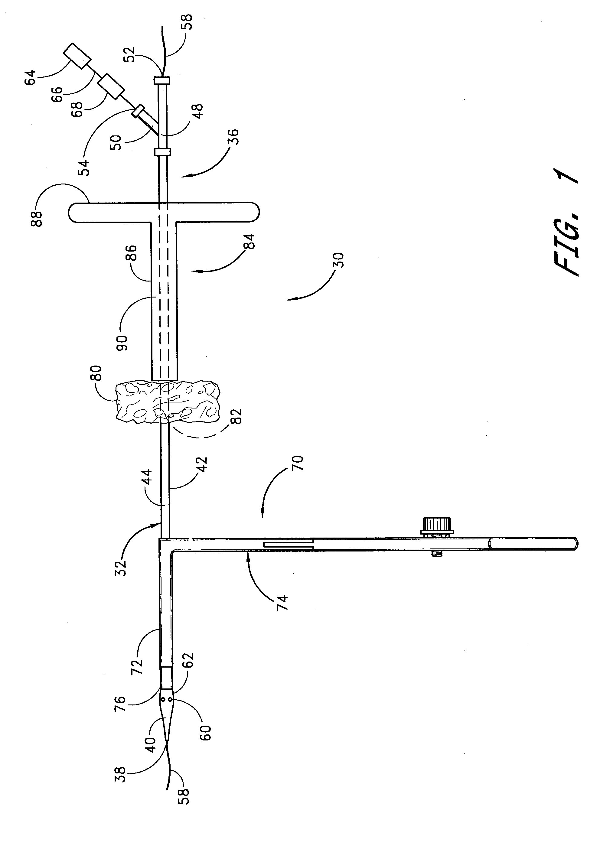 Apparatus for closing vascular puncture