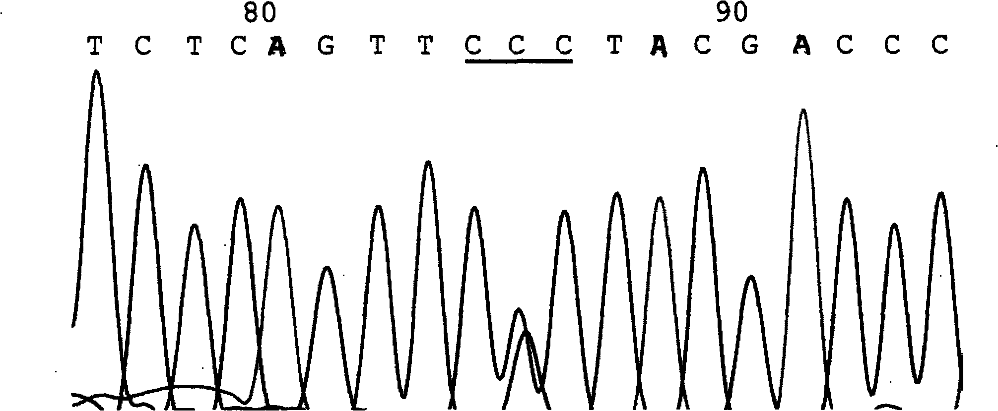 Kit for detecting 7 hot mutant sites of phenylketonuria PAH gene and PCR amplification method thereof