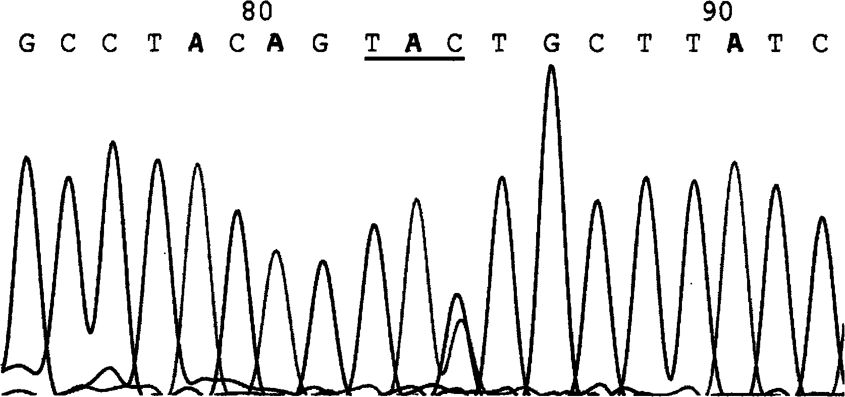 Kit for detecting 7 hot mutant sites of phenylketonuria PAH gene and PCR amplification method thereof