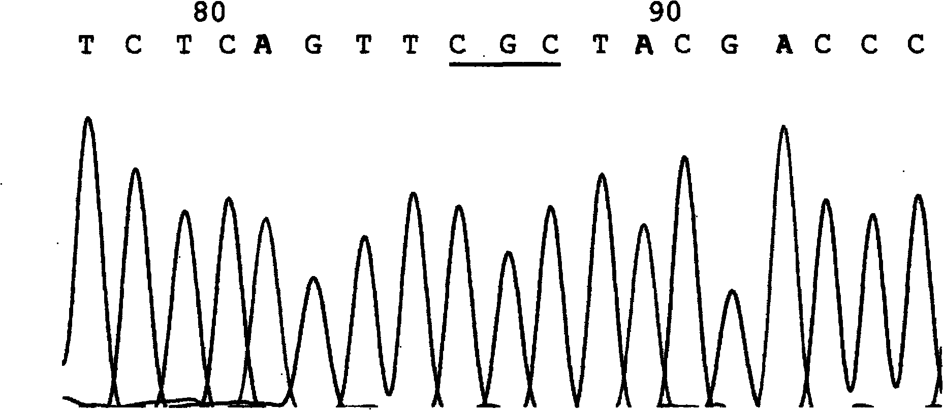 Kit for detecting 7 hot mutant sites of phenylketonuria PAH gene and PCR amplification method thereof