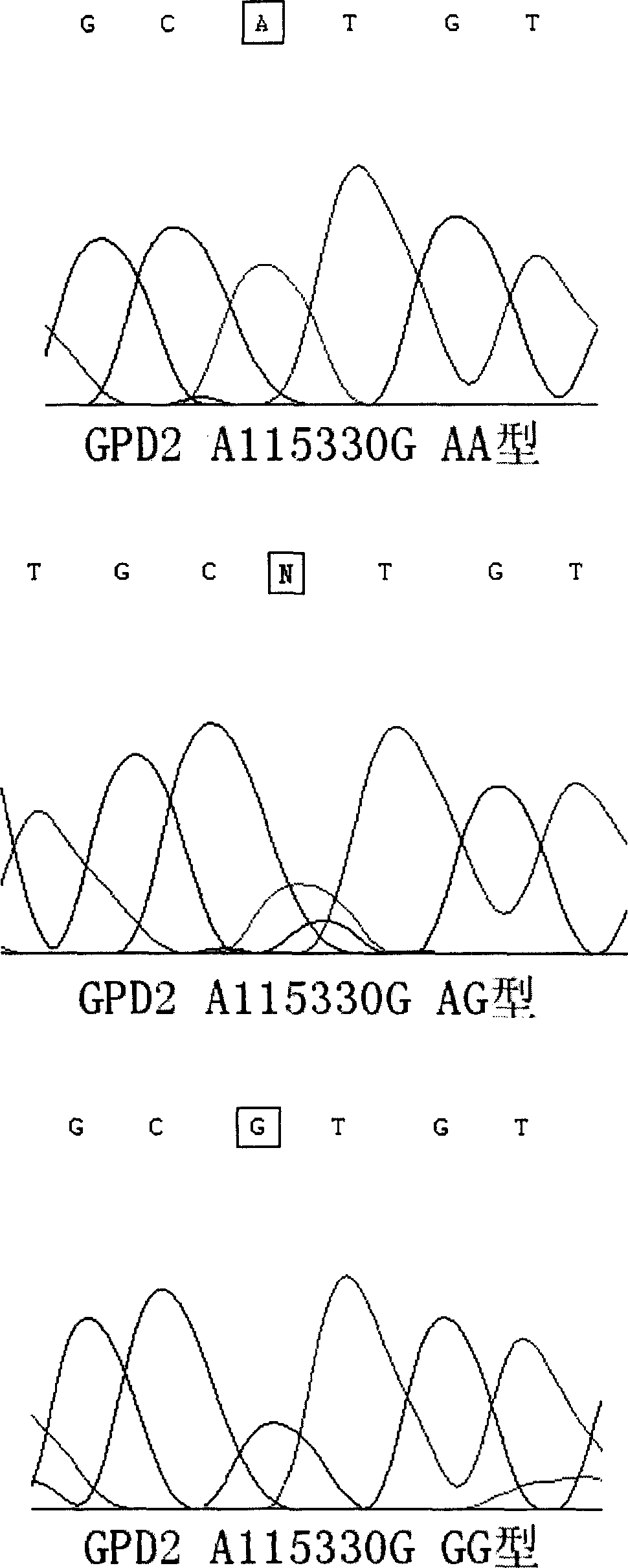 Relativity of glycerotriphosphate dehydrogenase gene with primary hypertension