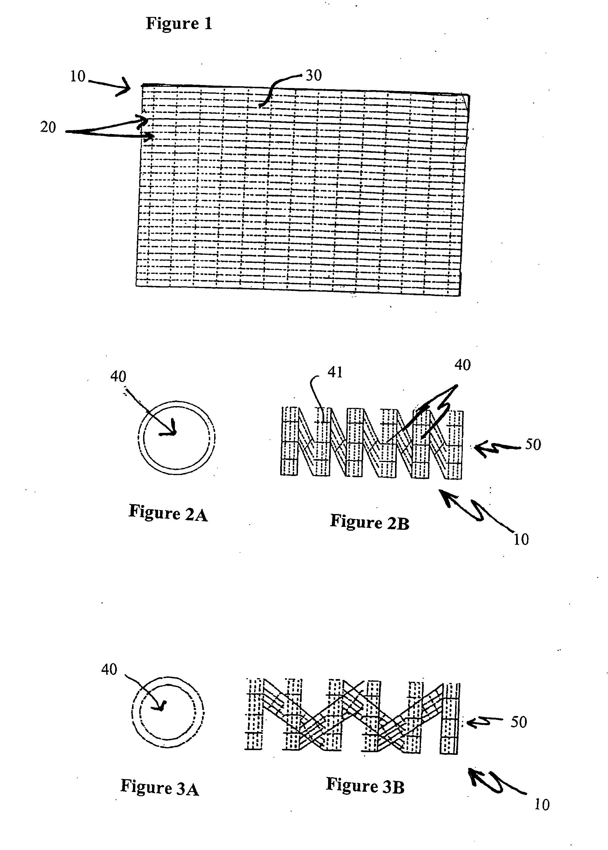 Biodegradable stents