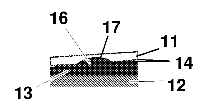 Angled sliding core, also as part of an intervertebral disc prosthesis, for the lumbar and cervical spine