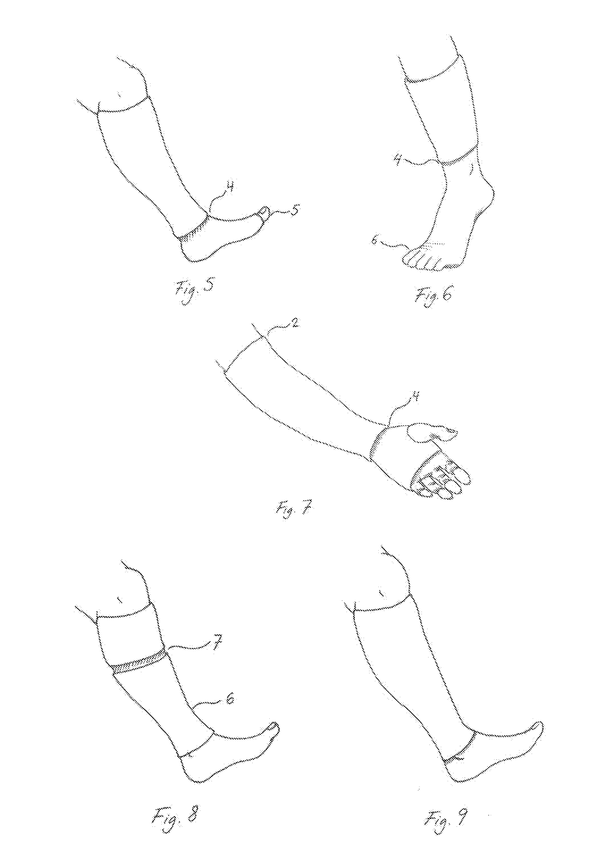 A compression garment for provision of an adjustable pressure