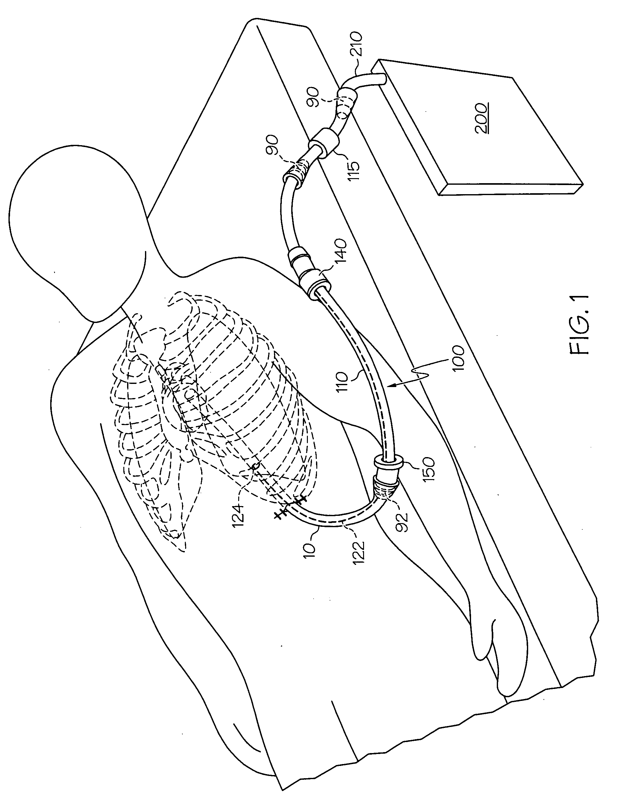 Methods and devices to clear obstructions from medical tubes