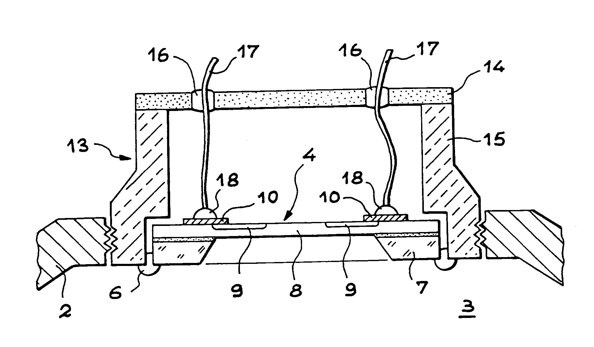 Membrane pressure sensor containing silicon carbide and method of manufacture