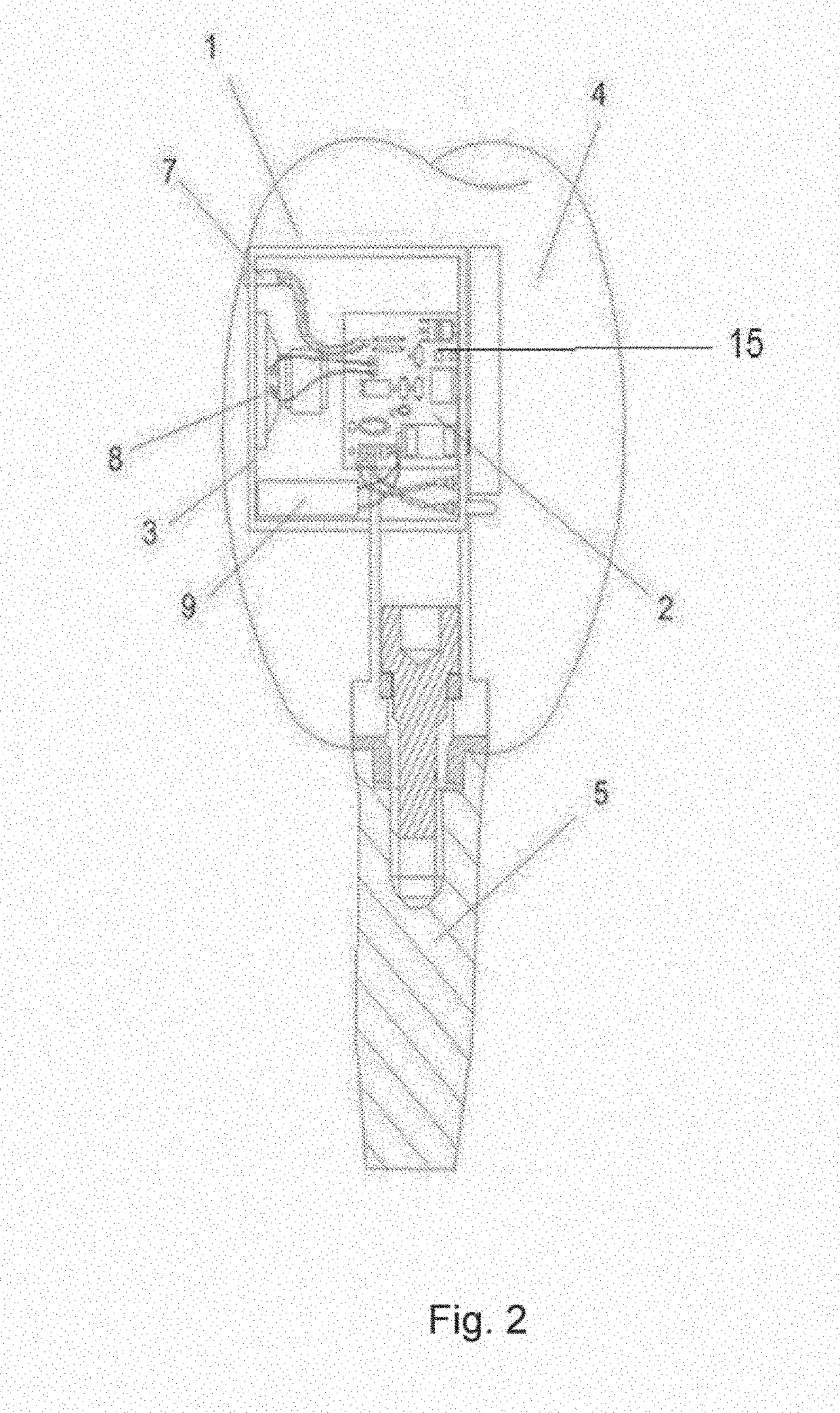 Intraoral device