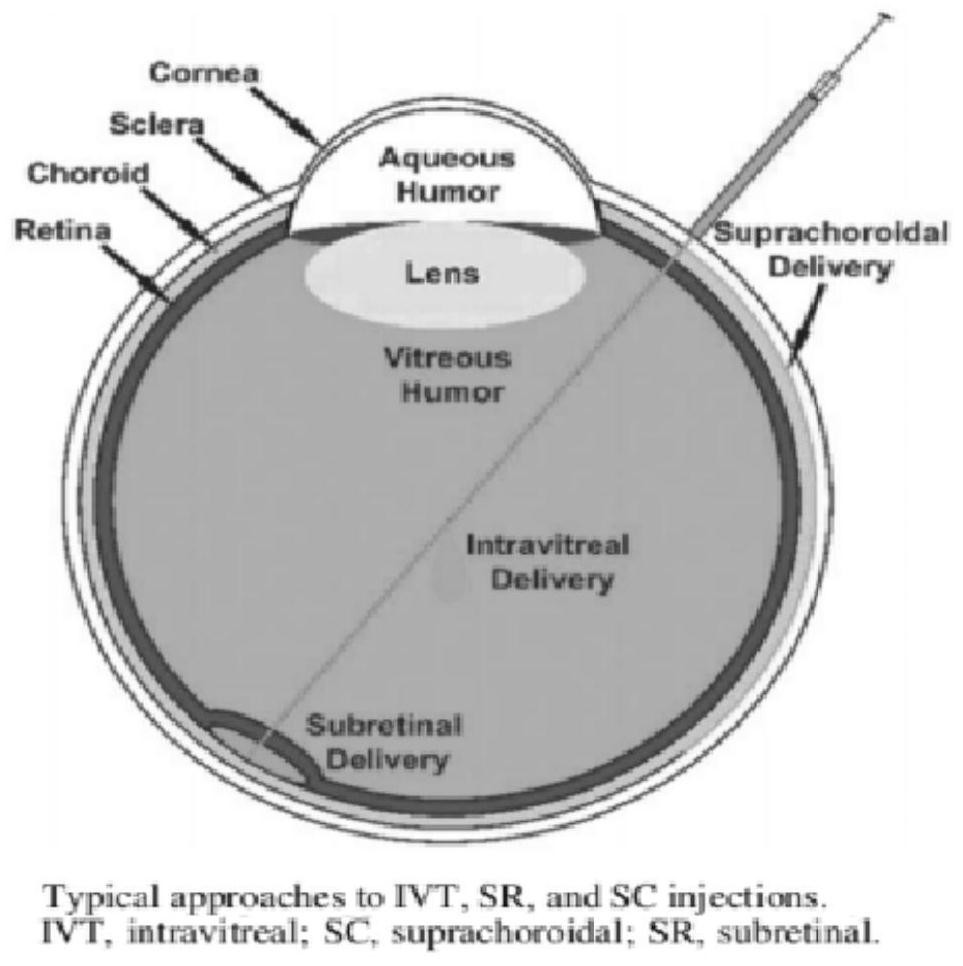 Medicine for treating age-related macular degeneration