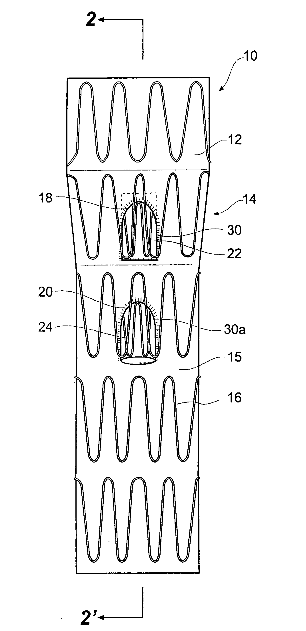 Side branch stent graft construction