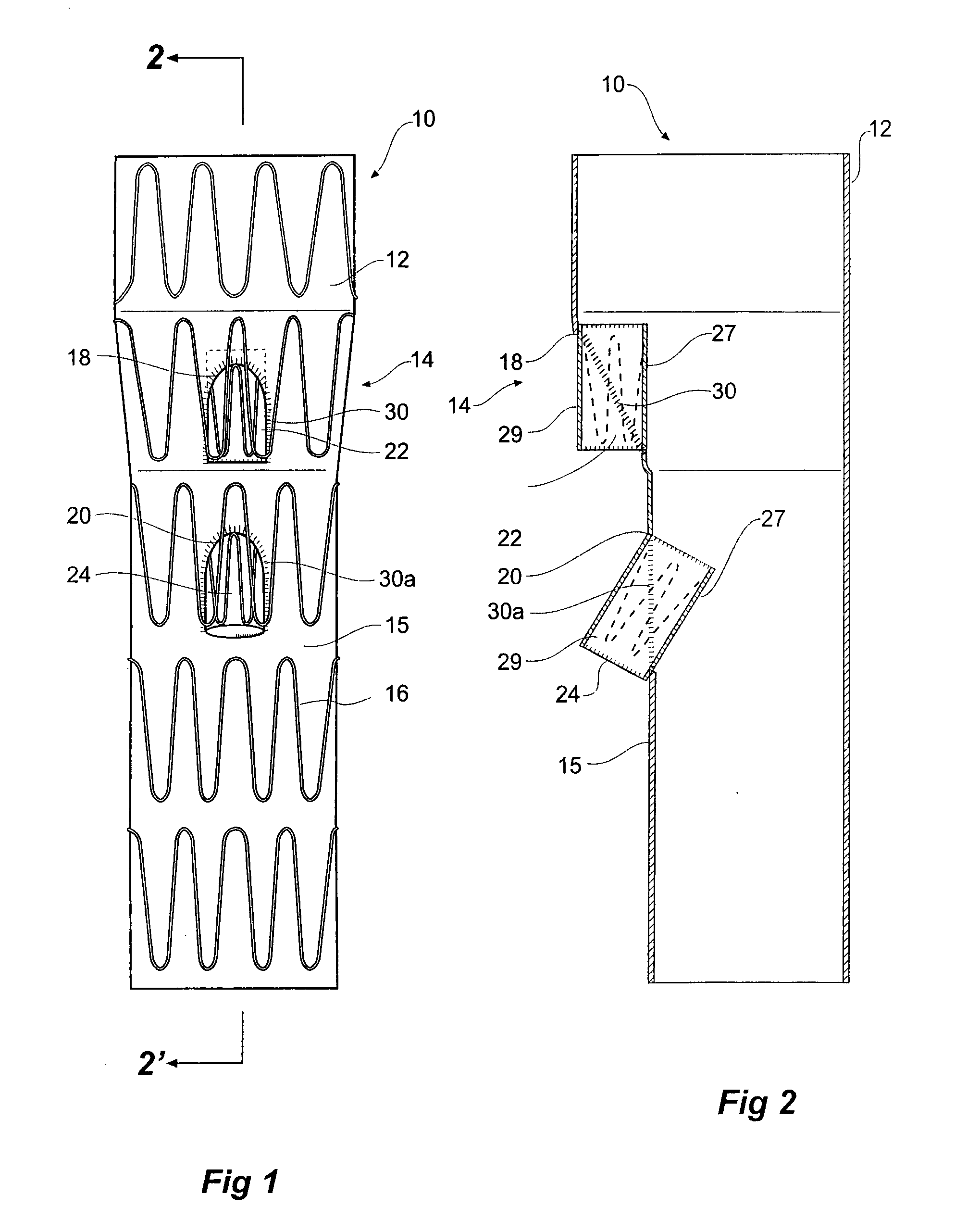 Side branch stent graft construction