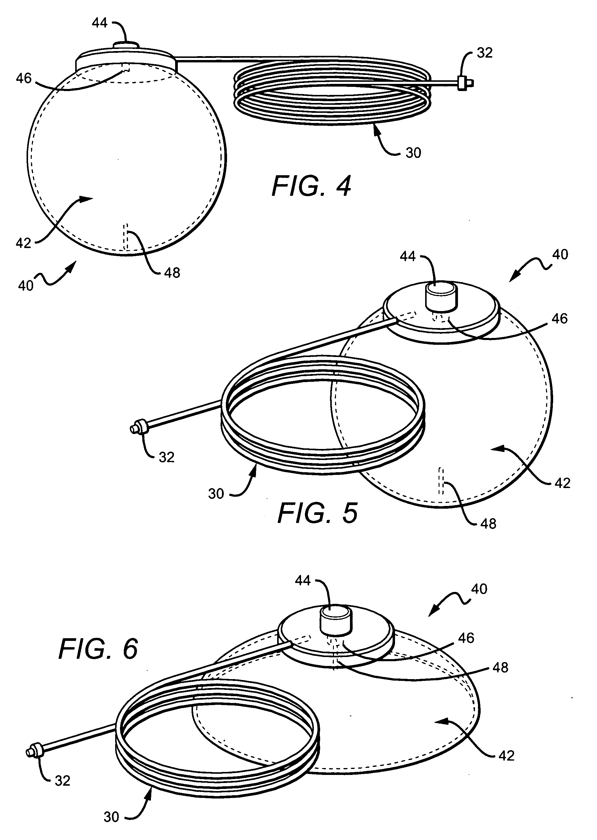 Corporeal drainage system