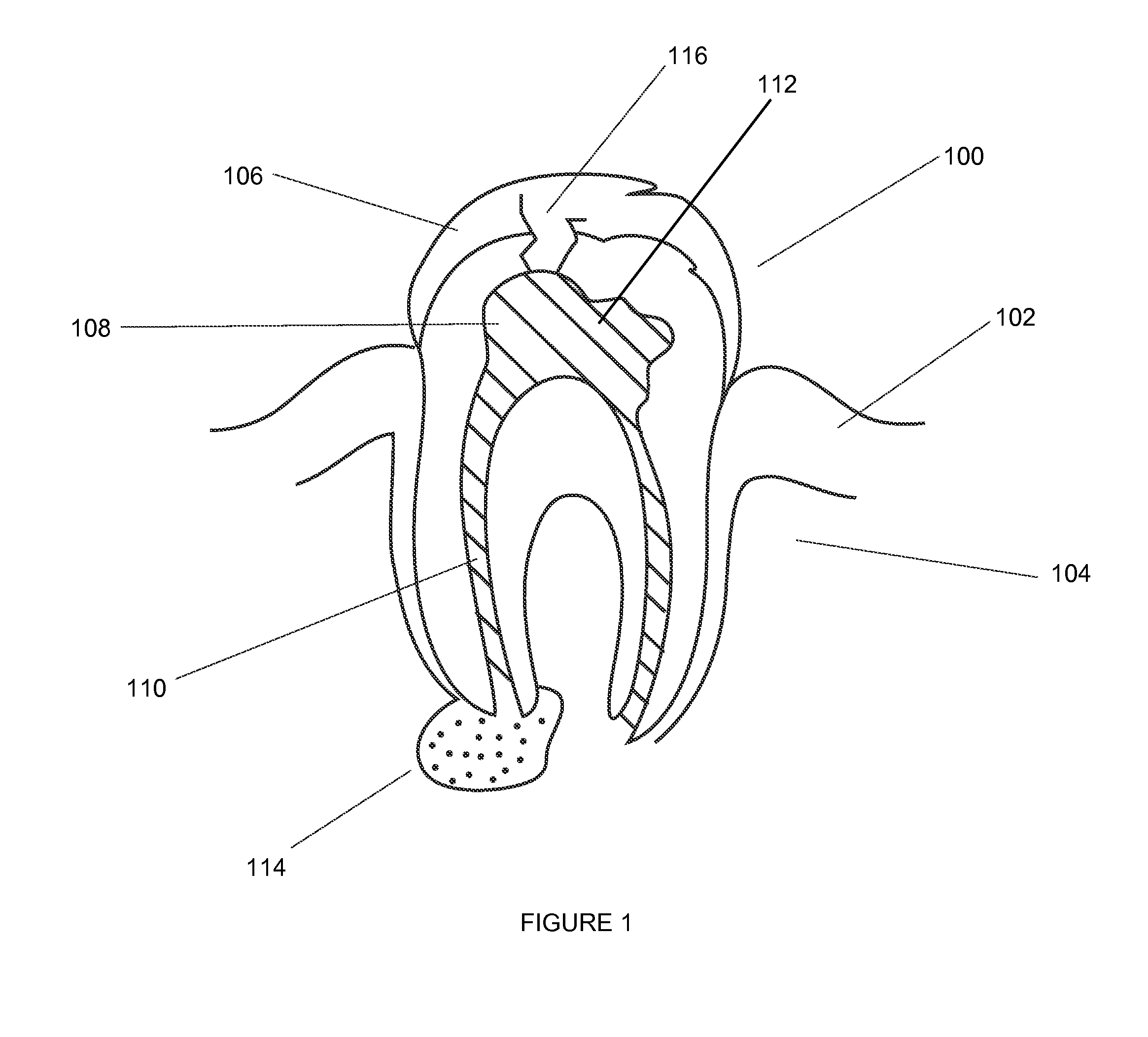 Single component tooth root sealer