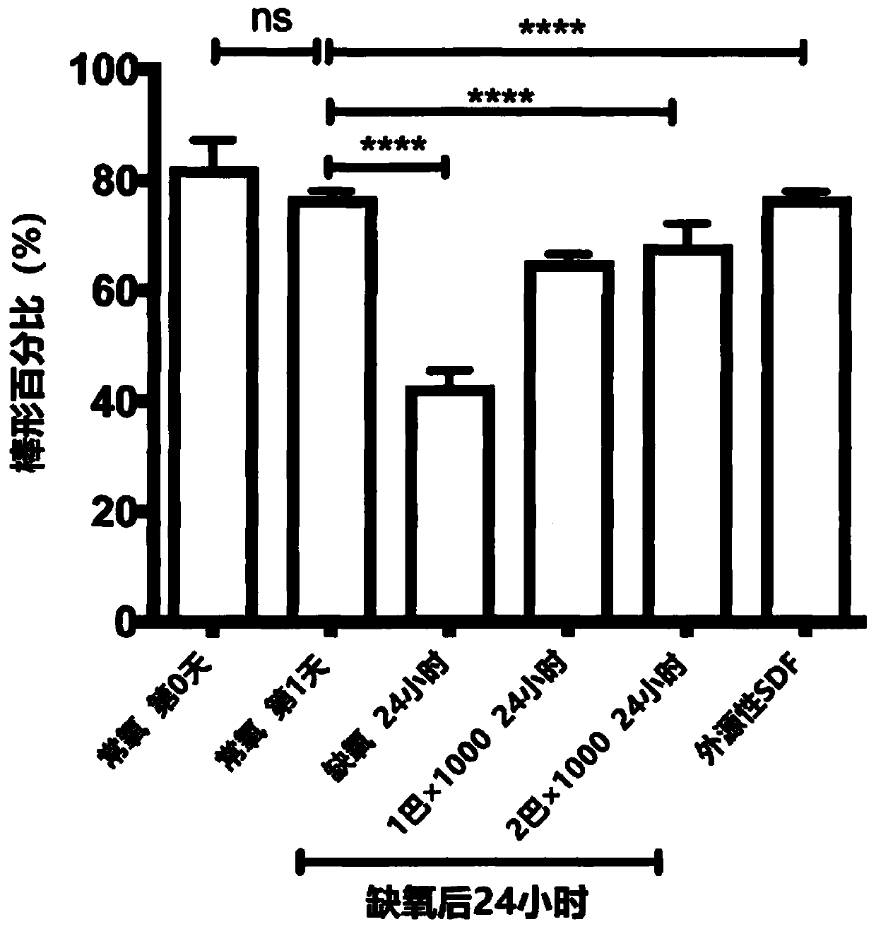 Treatments for heart failure and cardiac ischaemic reperfusion injury