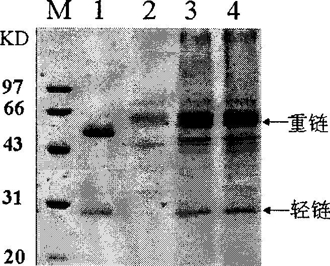 Recombinant Kluyveromyces sp. expressing antibody or antibody analogue, and construction method and use thereof