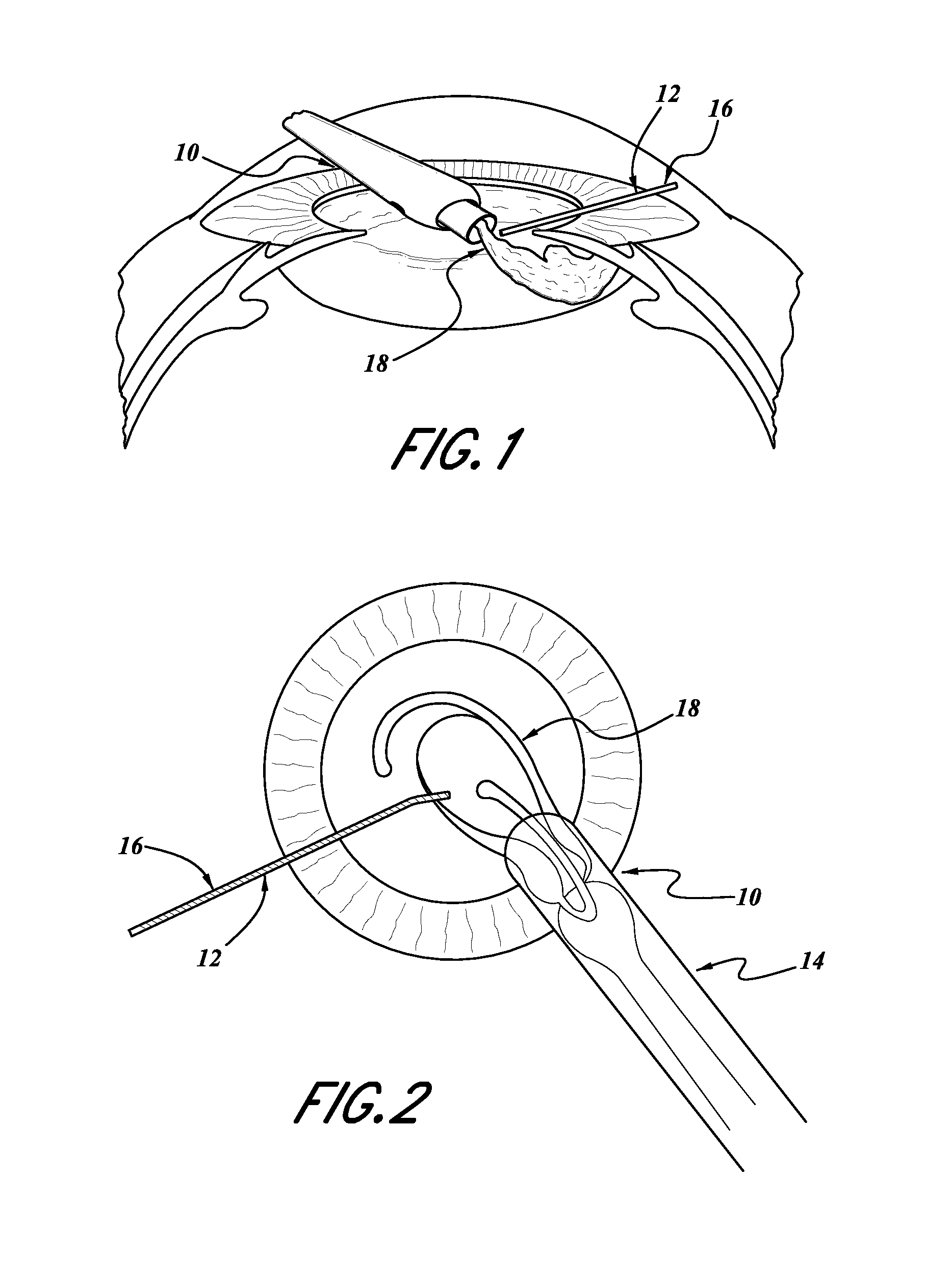 Intraocular lens inserters