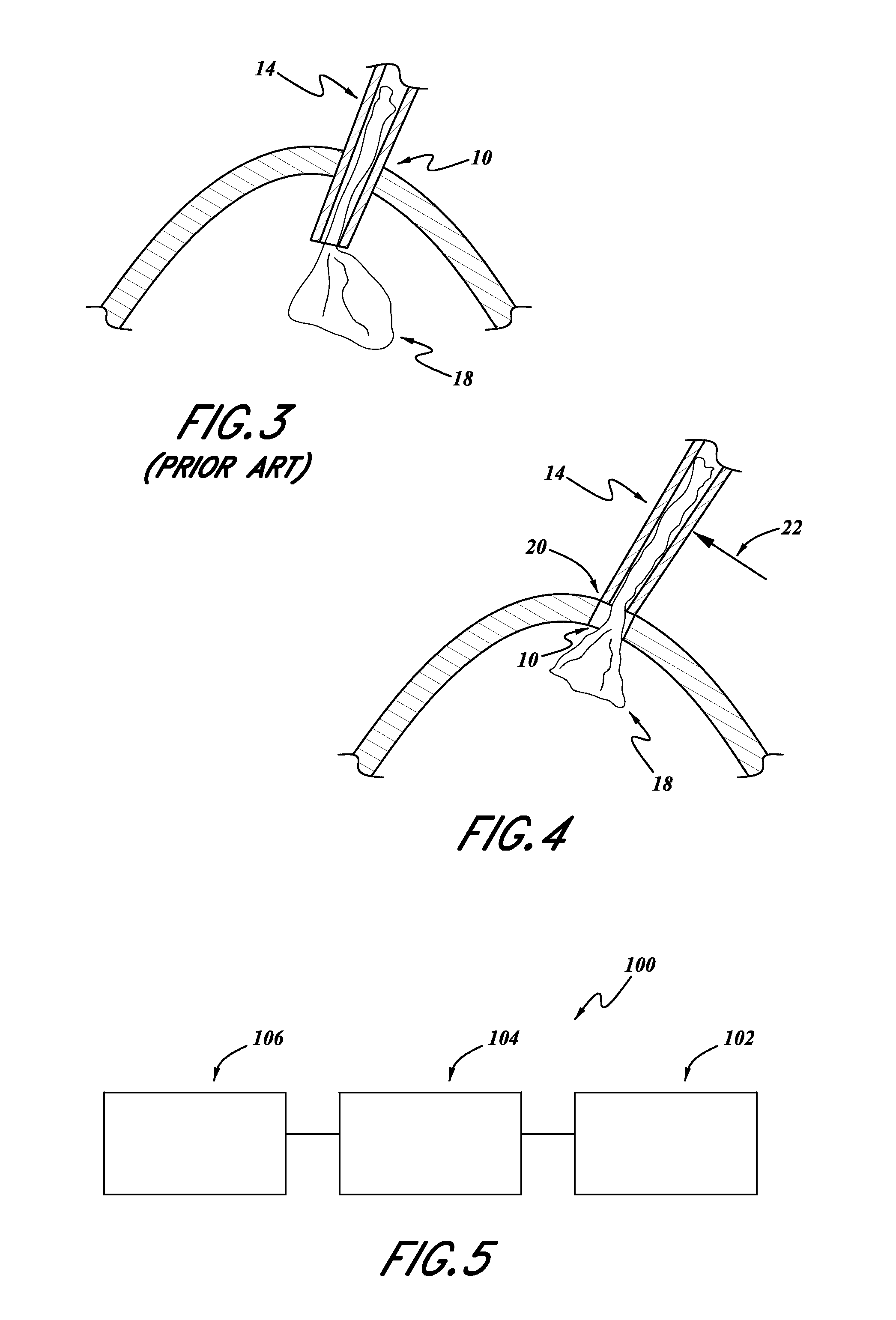 Intraocular lens inserters