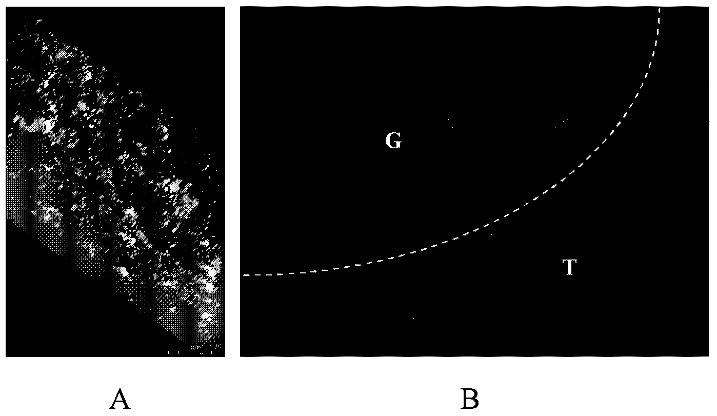 Hyaluronic acid-orientated channel composite bracket material used for spinal cord injury repair