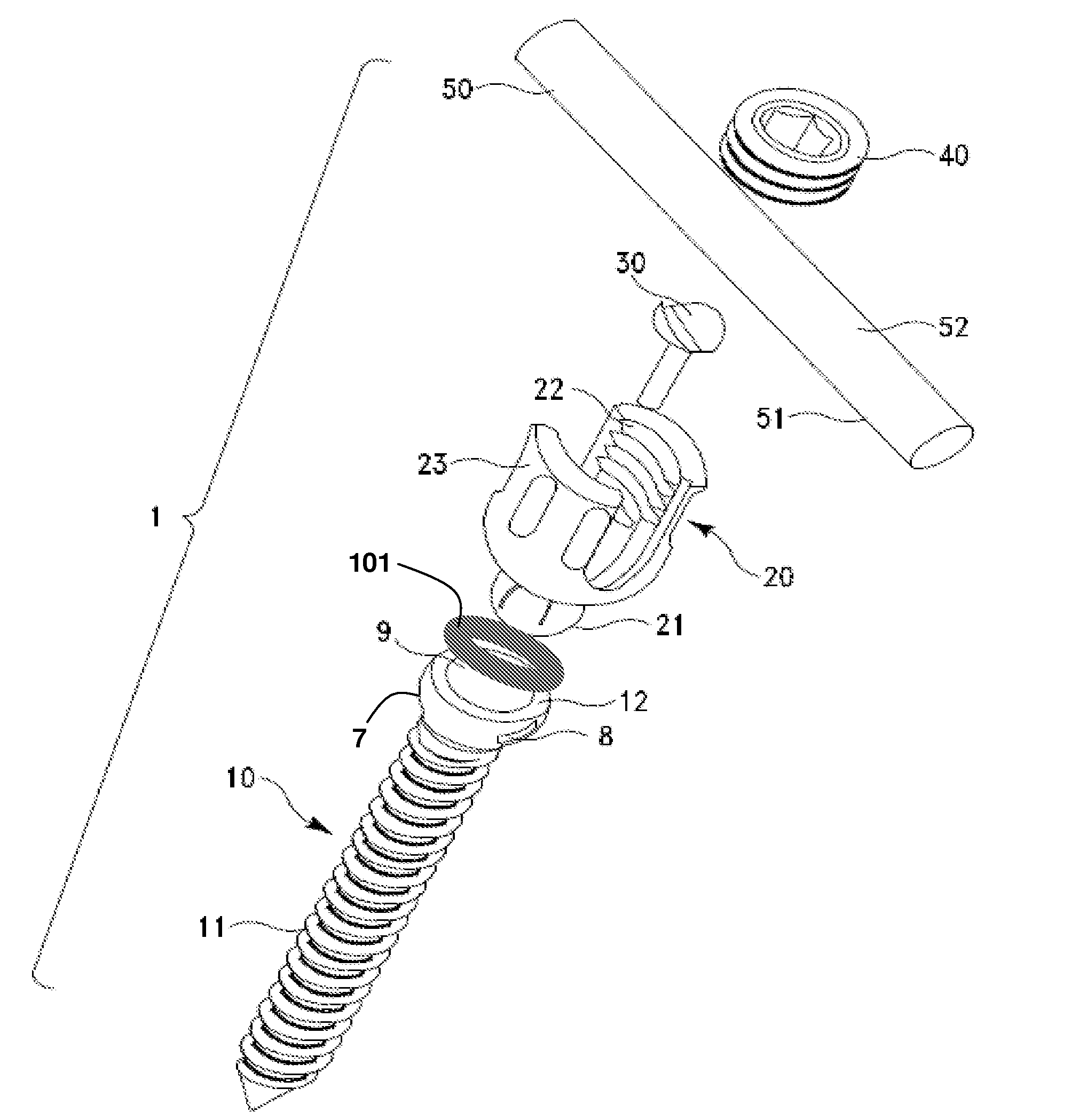 Spring-loaded, load sharing polyaxial pedicle screw assembly and method