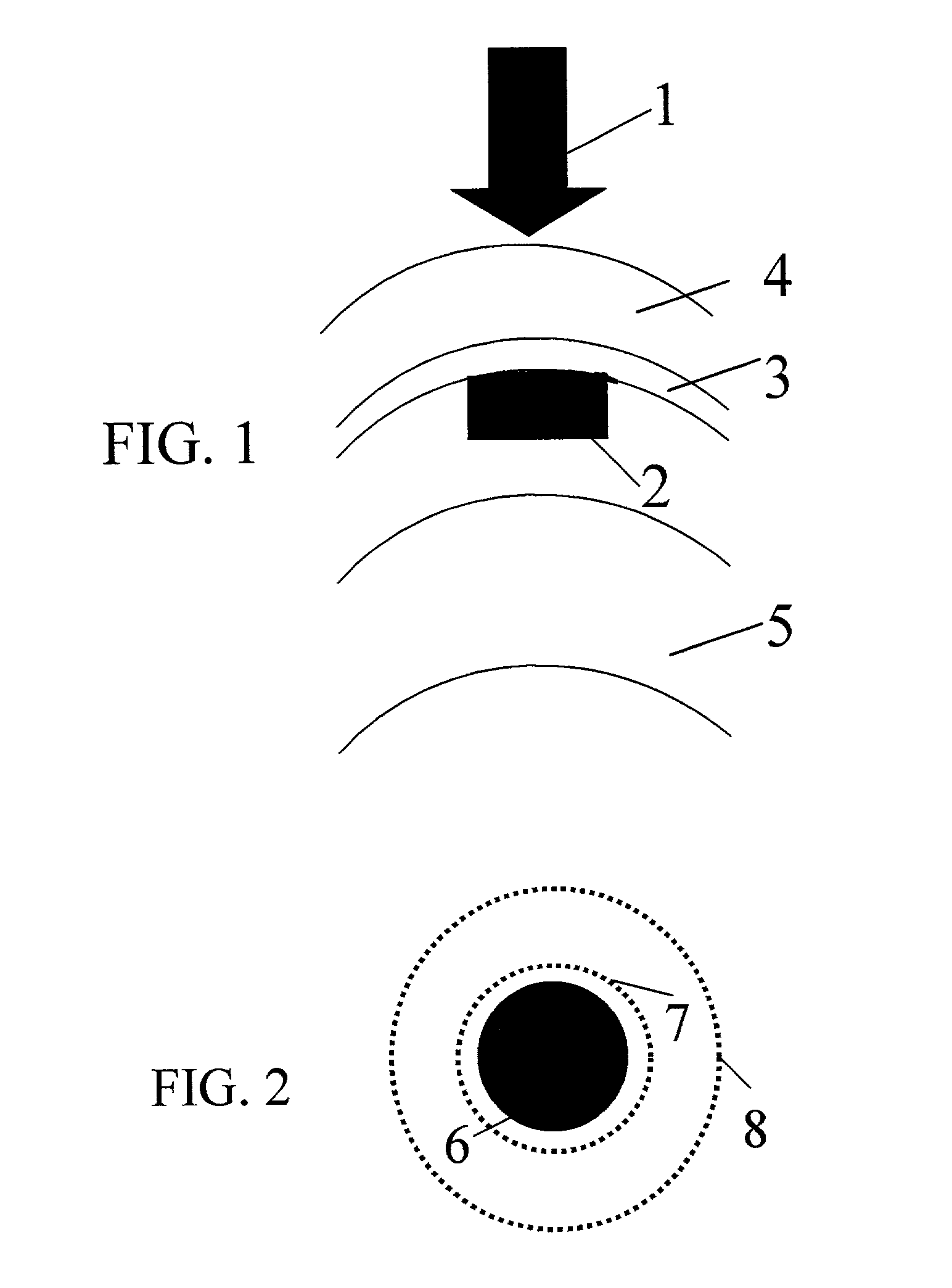 Method and apparatus for treatment of presbyopia by lens relaxation and anterior shift