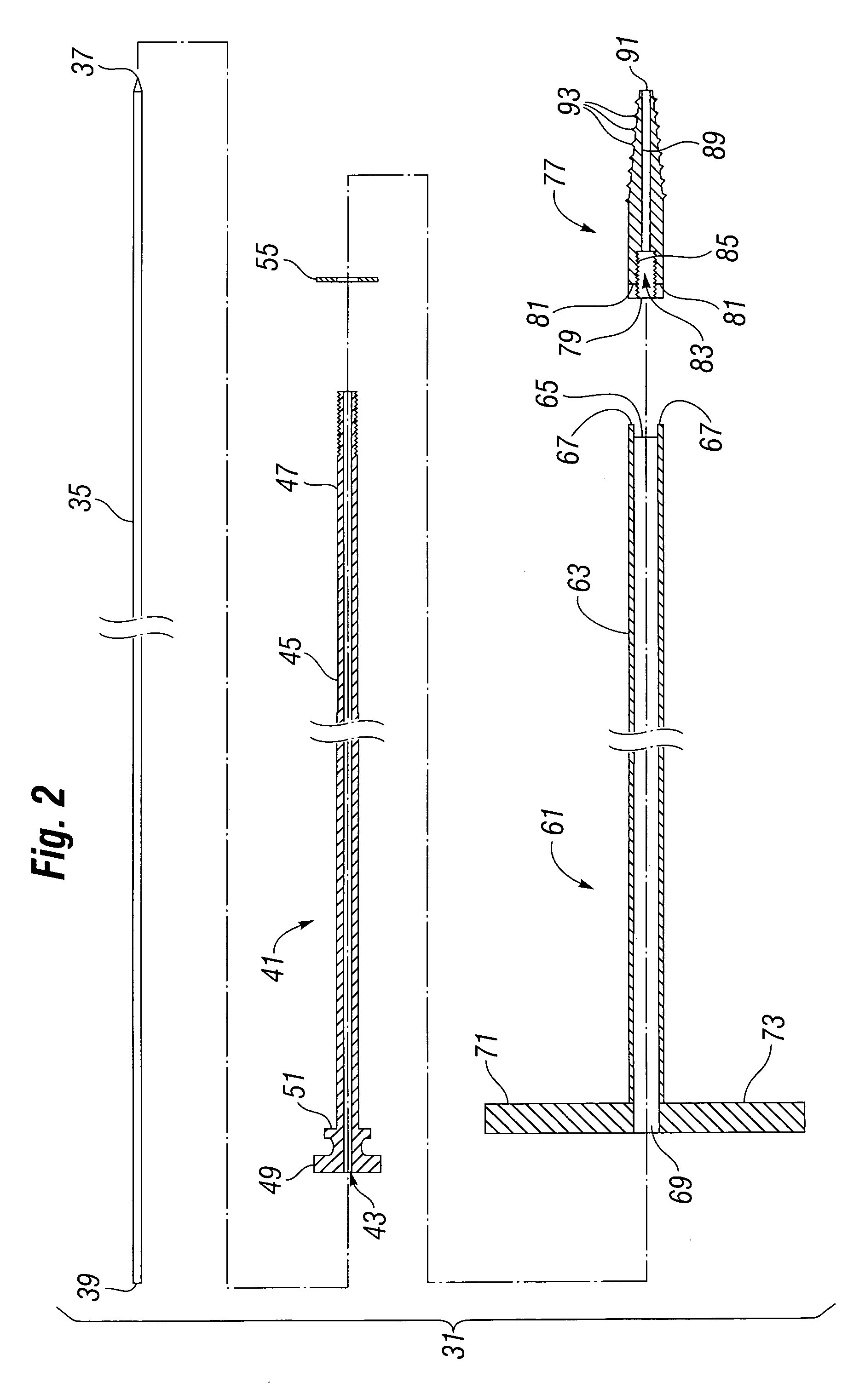 Pedicle dart system