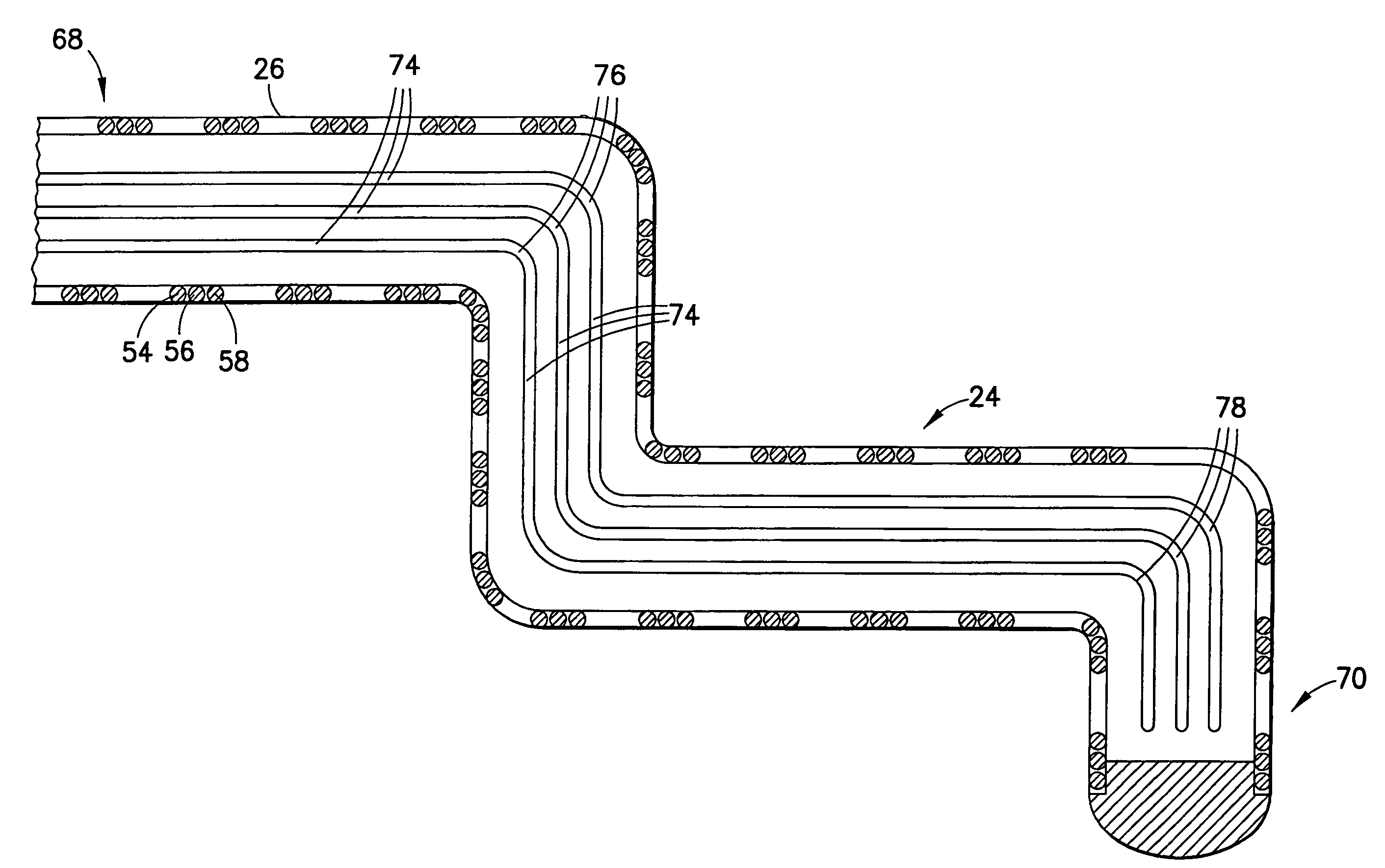 Super plastic design for CHF pacemaker lead