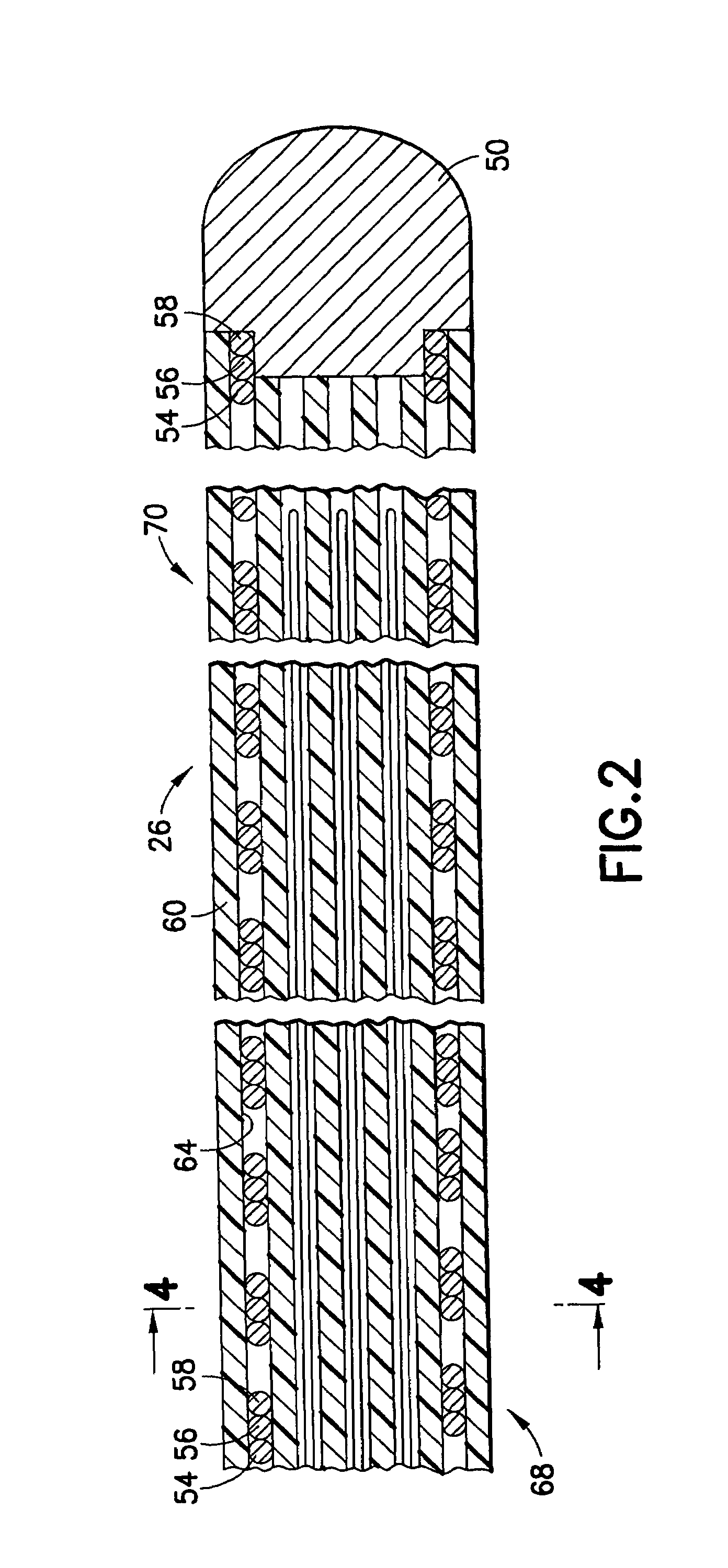 Super plastic design for CHF pacemaker lead