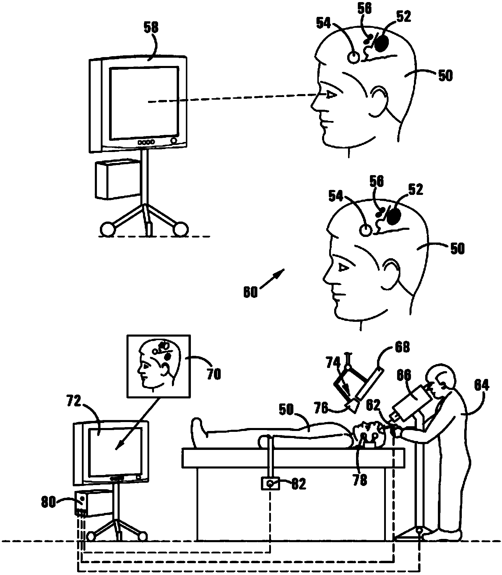 Method of and system for overlaying NBS functional data on a live image of a brain