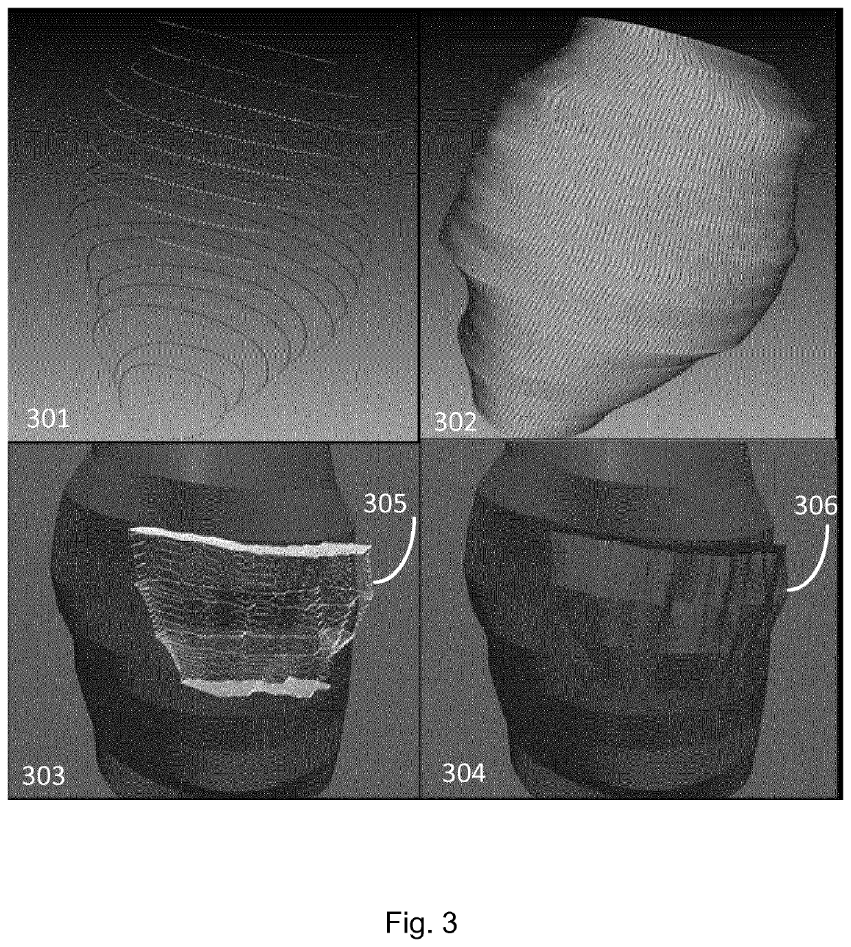 Methods and systems for guidance in cardiac resynchronization therapy