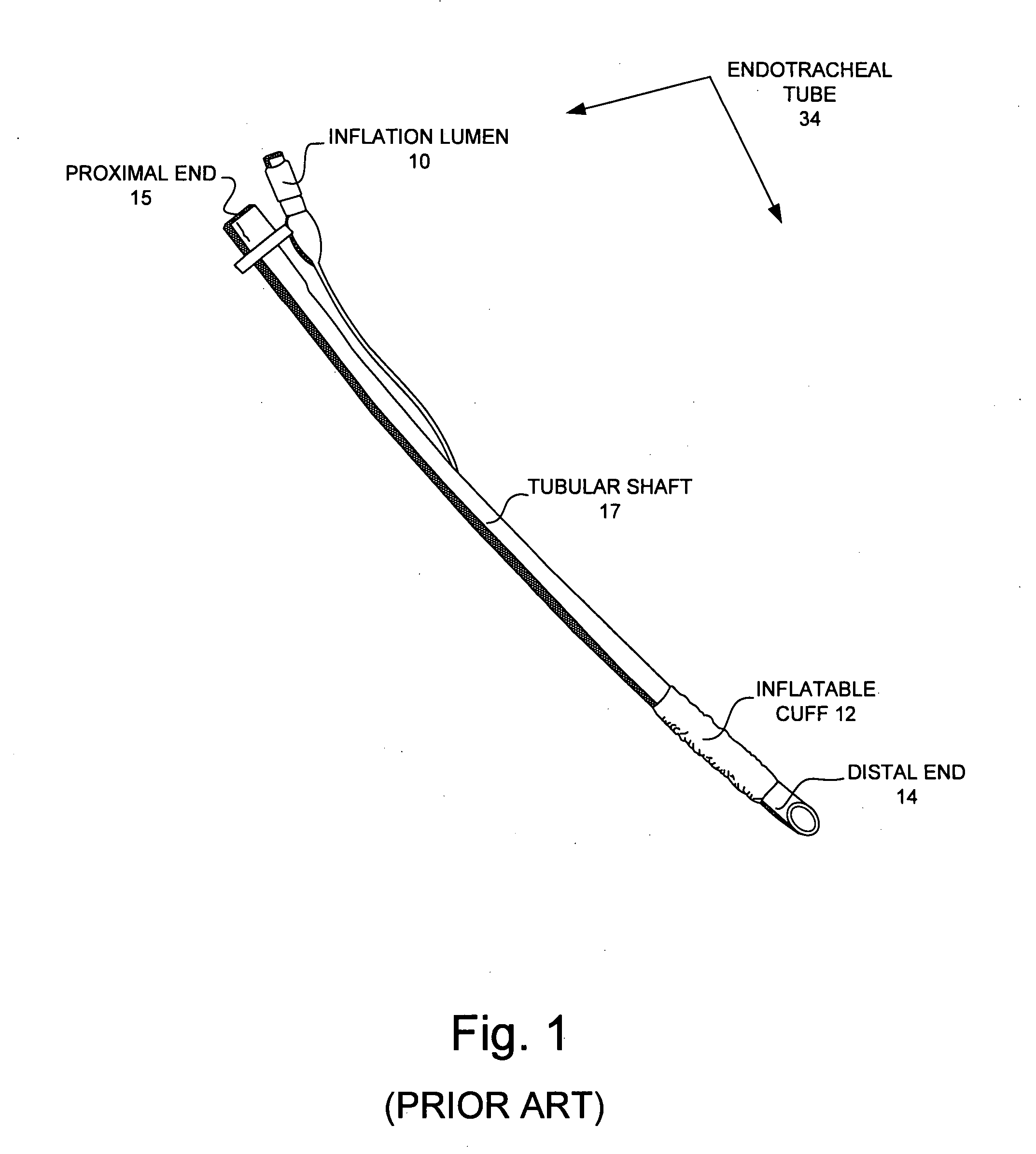 Extendable lighted intubation stylet