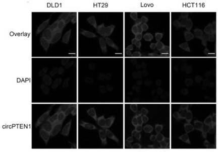 CircPTEN1 for tumor treatment target and diagnosis biomarker and application of circPTEN1