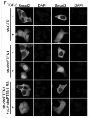 CircPTEN1 for tumor treatment target and diagnosis biomarker and application of circPTEN1