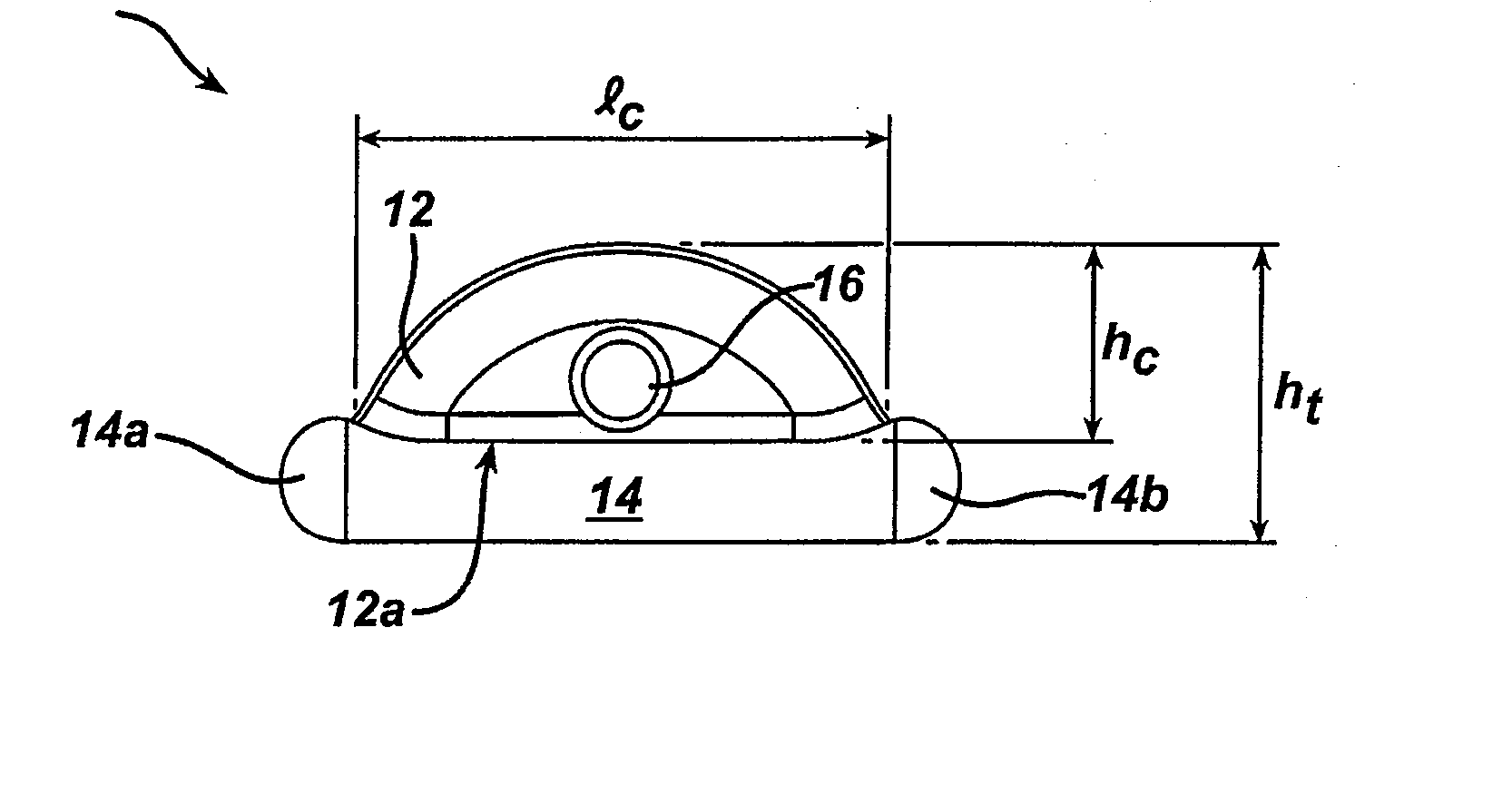 Methods and devices for repairing triangular fibrocartilage complex tears